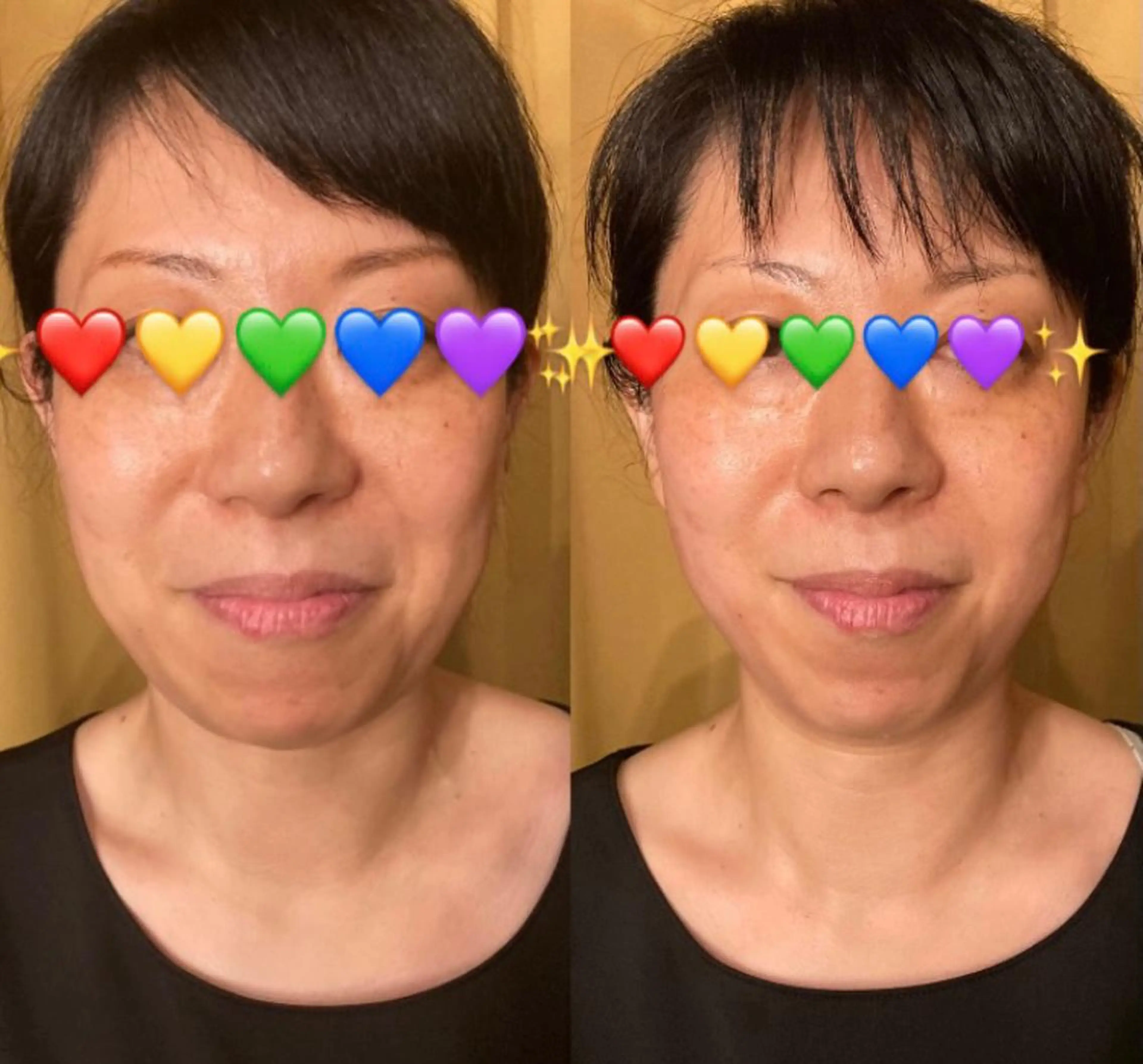 小顔やたるみに特化 💚野瀬可蓮のその他イメージ