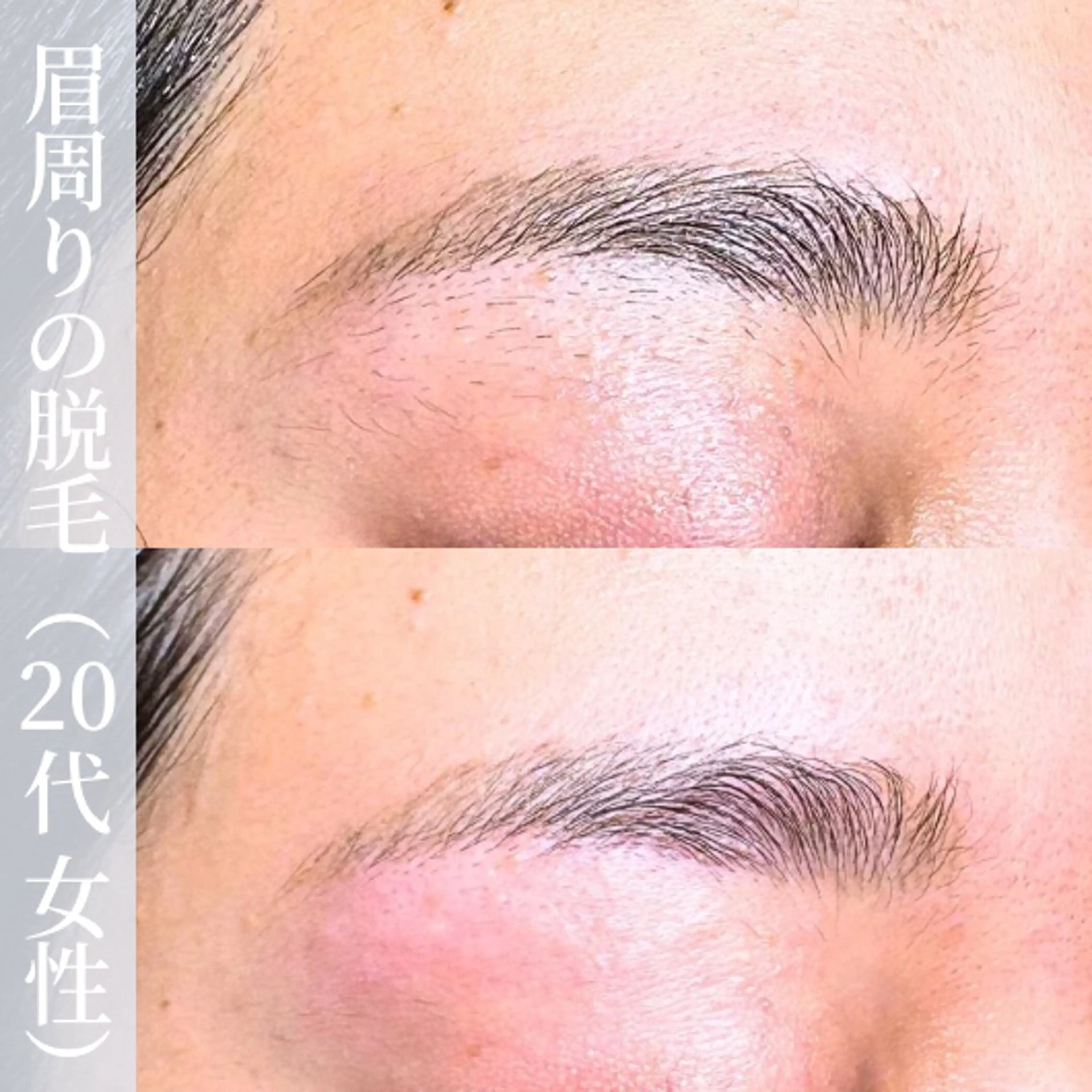 アイブロウ 眉毛ワックス脱毛 【一本ずつ脱毛】 ReMove 柏のエステ・リラクイメージ