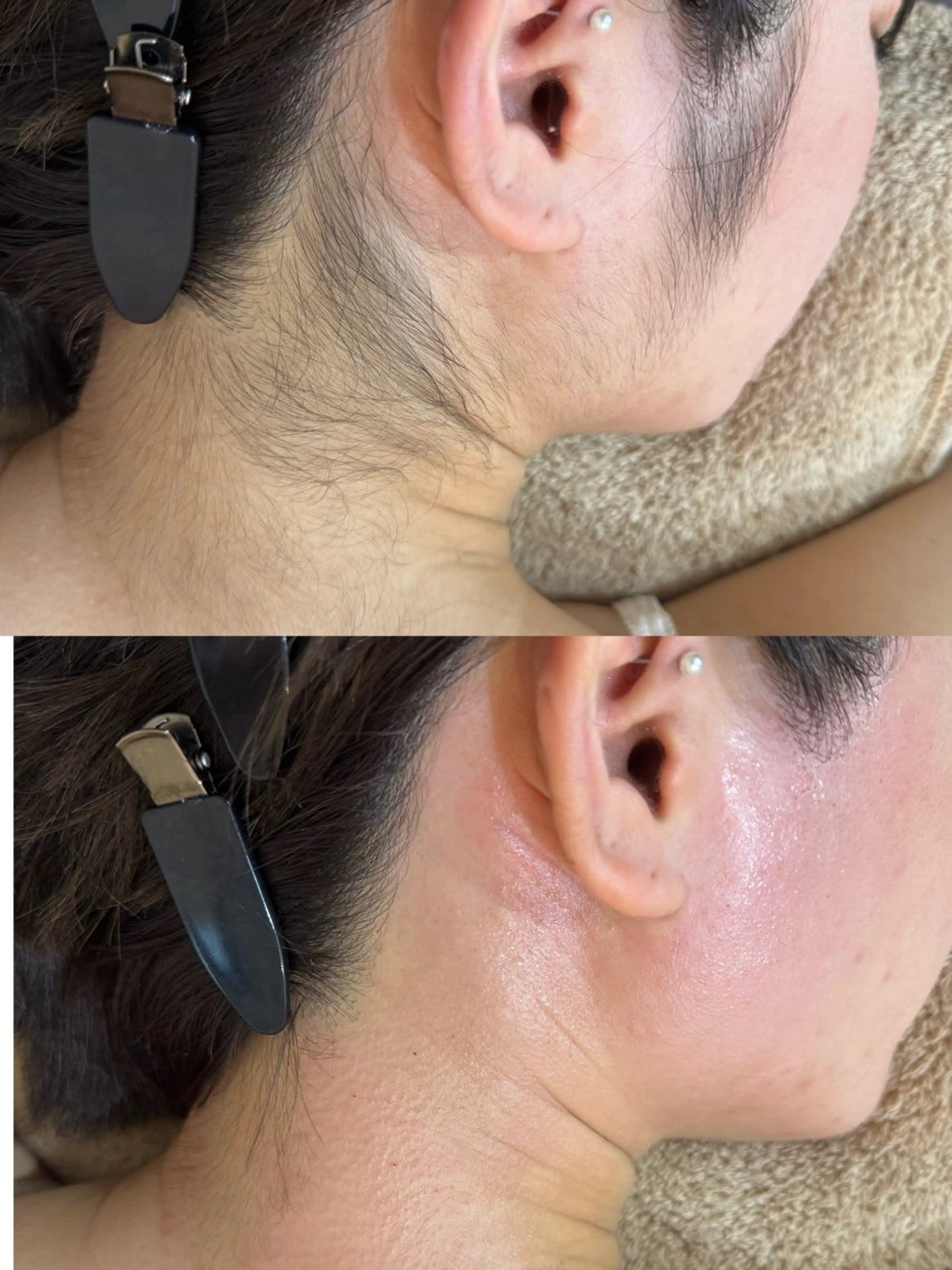 脱毛 ワックス脱毛/光脱毛 🎀新宿駅徒歩5分のエステ・リラクイメージ