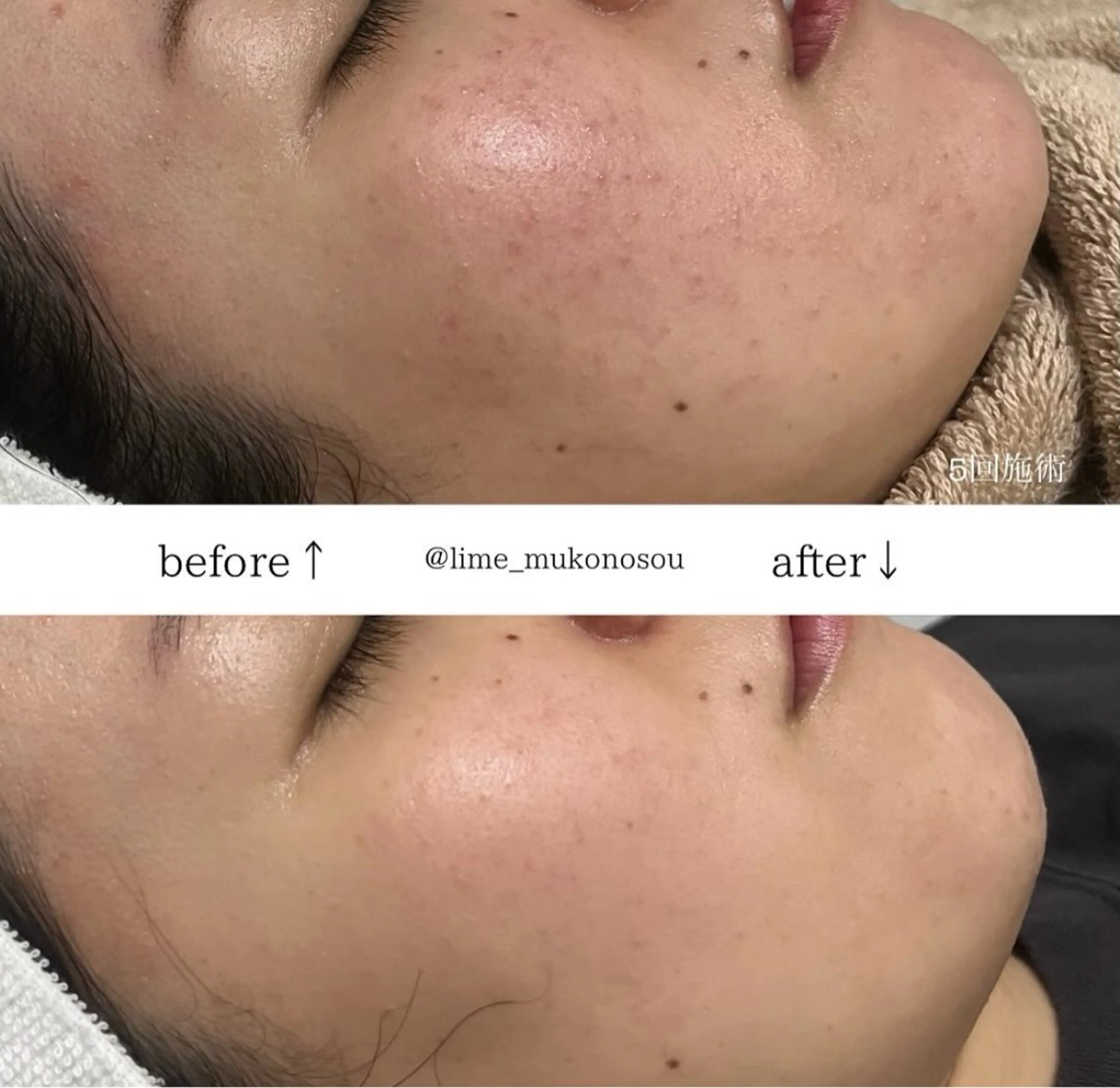 LIME 武庫之荘店のエステ・リラクイメージ