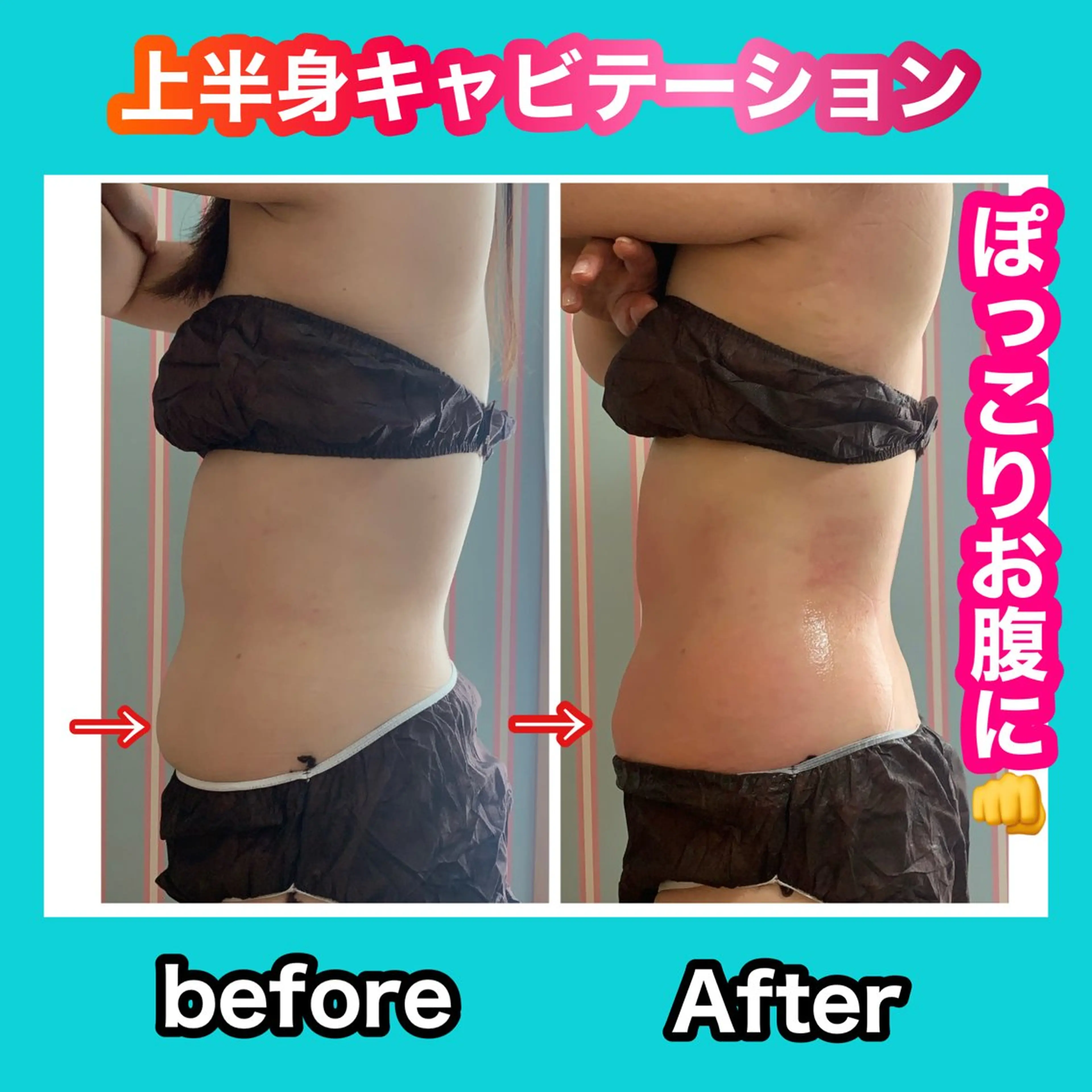 エステ リラク 痩身/脱毛/ネイル HARUKAのエステ・リラクイメージ