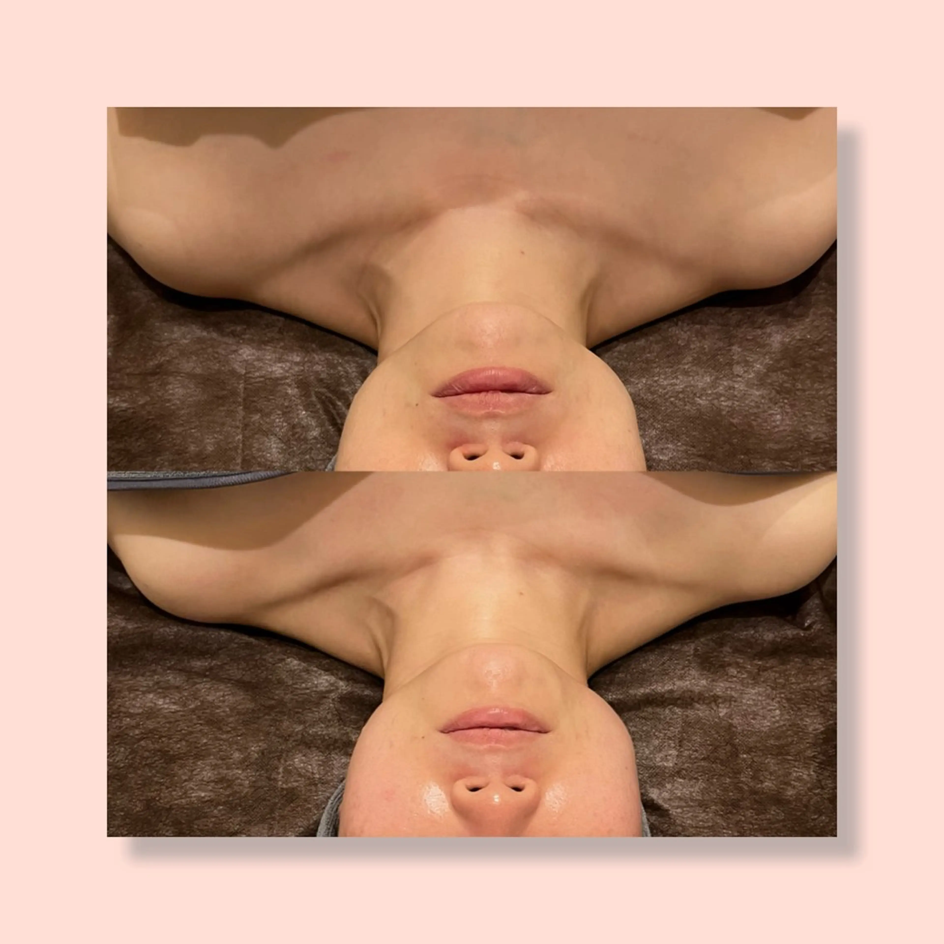 小顔コルギ ☆表参道/外苑前のエステ・リラクイメージ