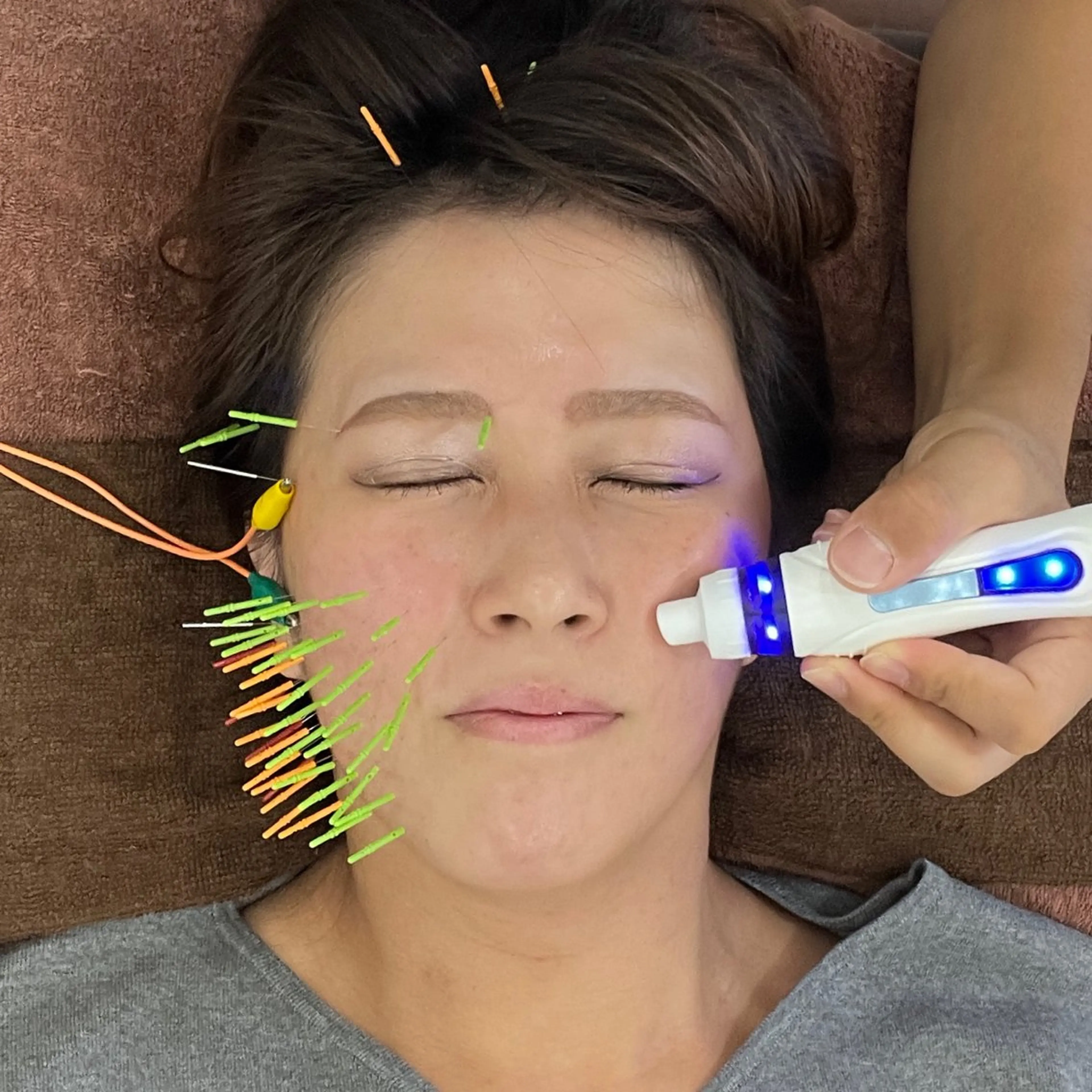 美容鍼×小顔×猫背× ブライダル 大阪梅田のエステ・リラクイメージ