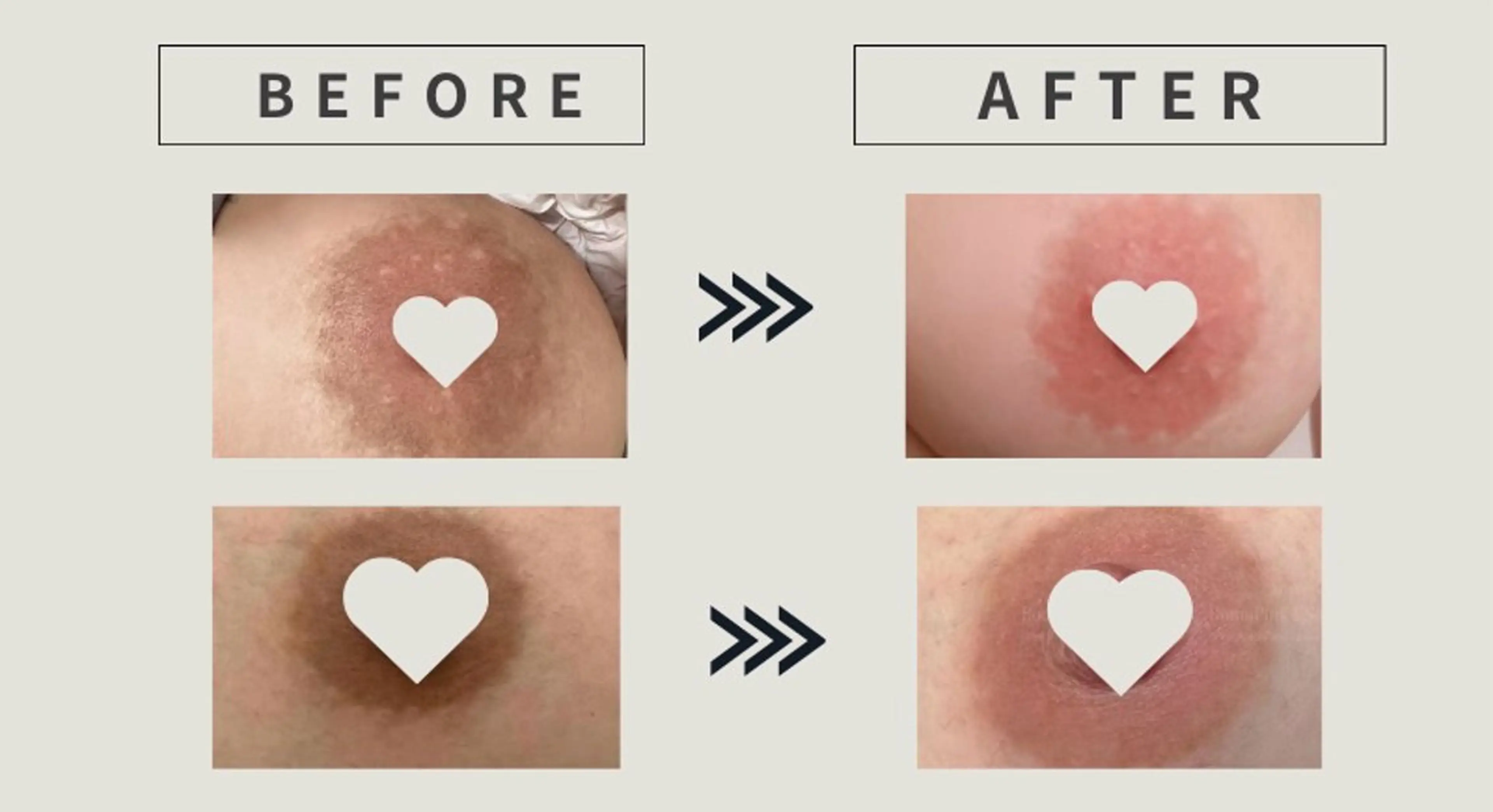 小顔/たるみ/黒ずみ除去専門サロン/SONA 大和西大寺店所属・【小顔痩身専門看護師 サロンSONA】のエステ・リラクイメージ