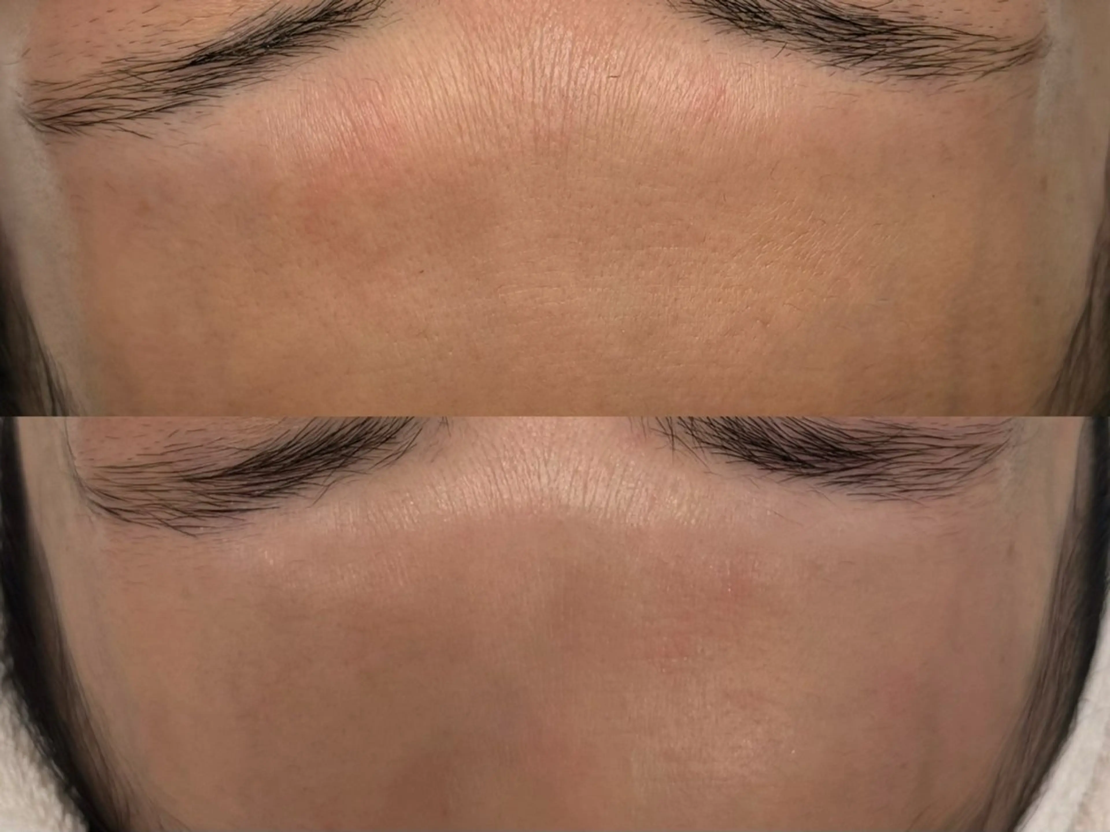 小顔/毛穴/ニキビ salon bealのエステ・リラクイメージ