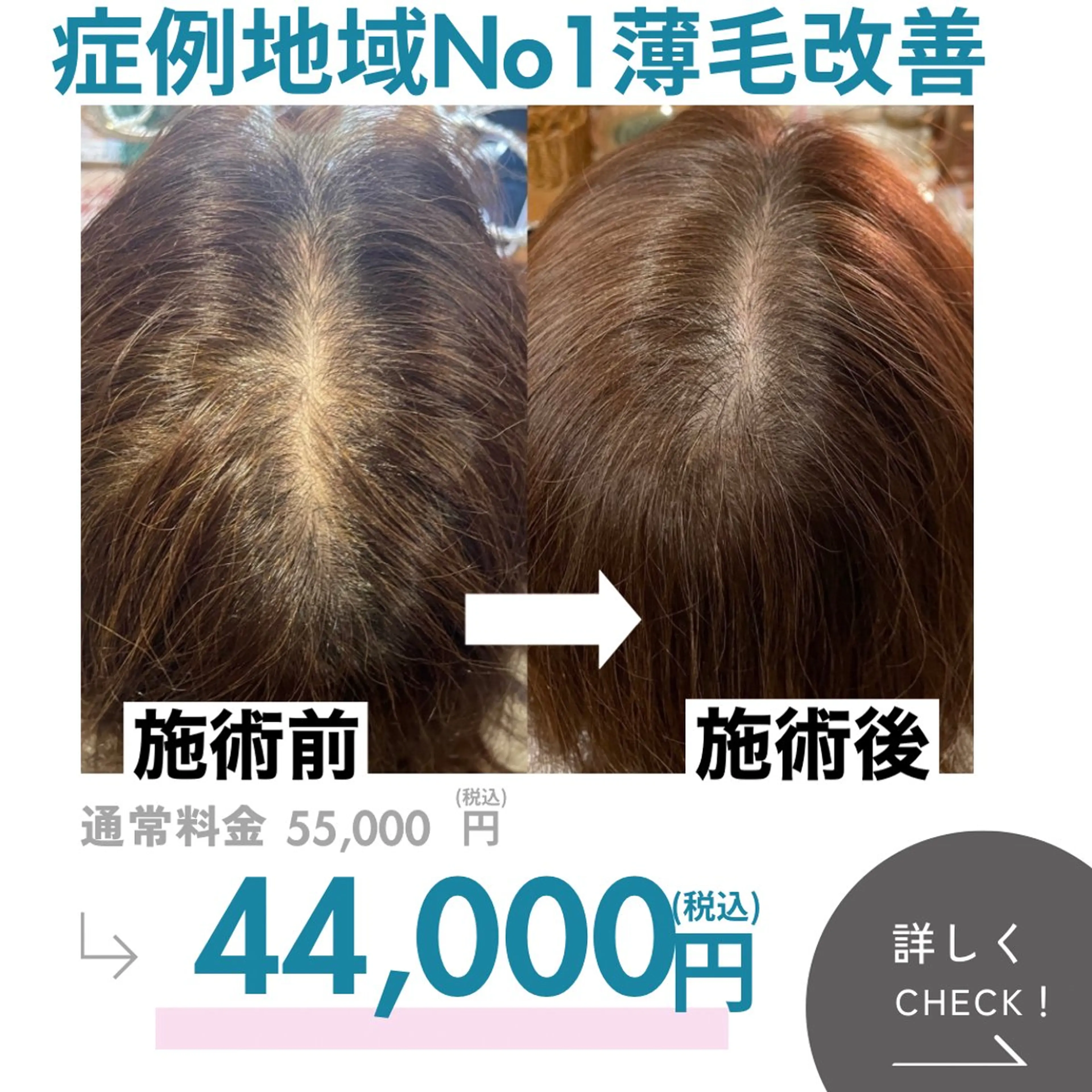 最速 毛穴シミ改善 いくえのその他イメージ