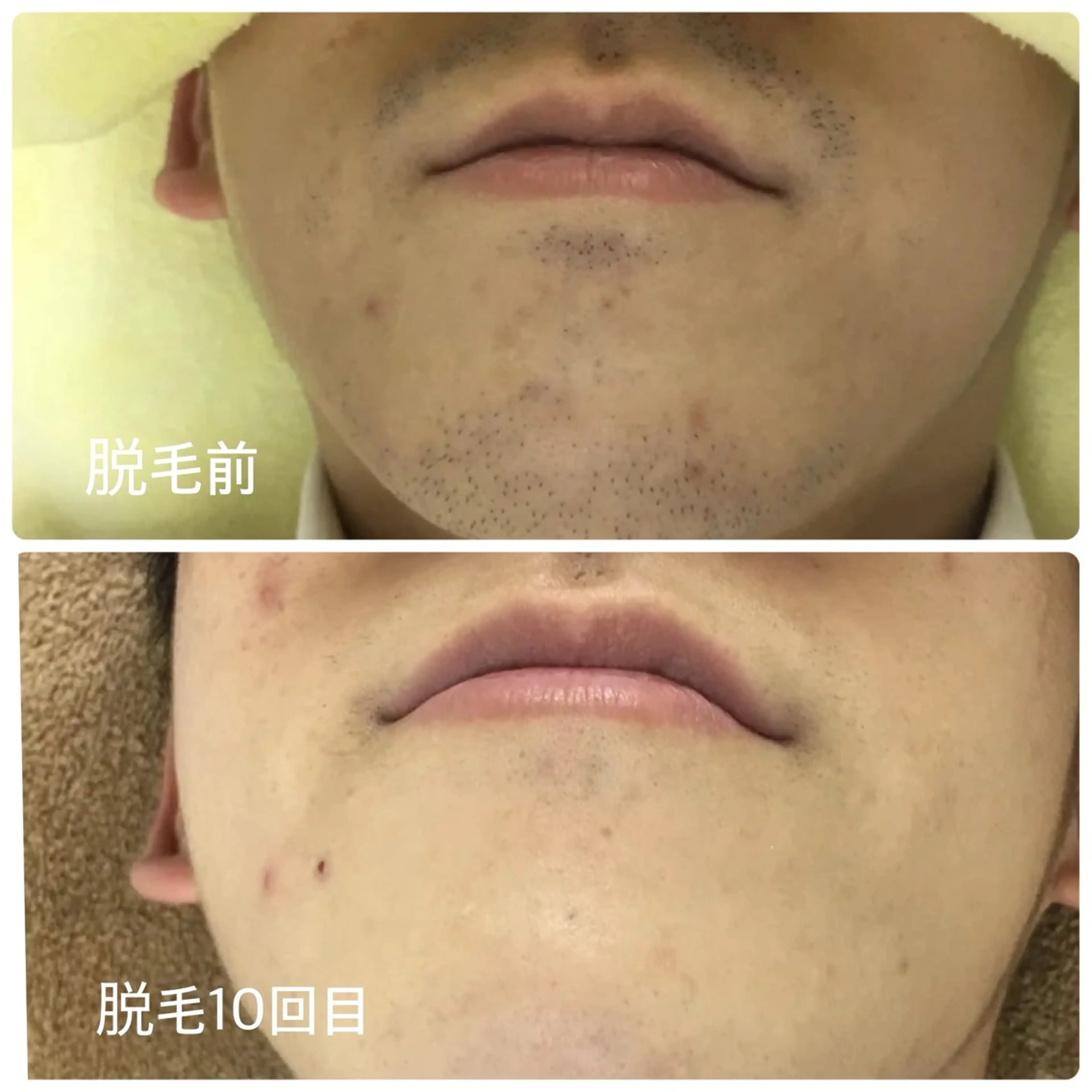 脱毛 脱毛サロン ベル・マタンのエステ・リラクイメージ