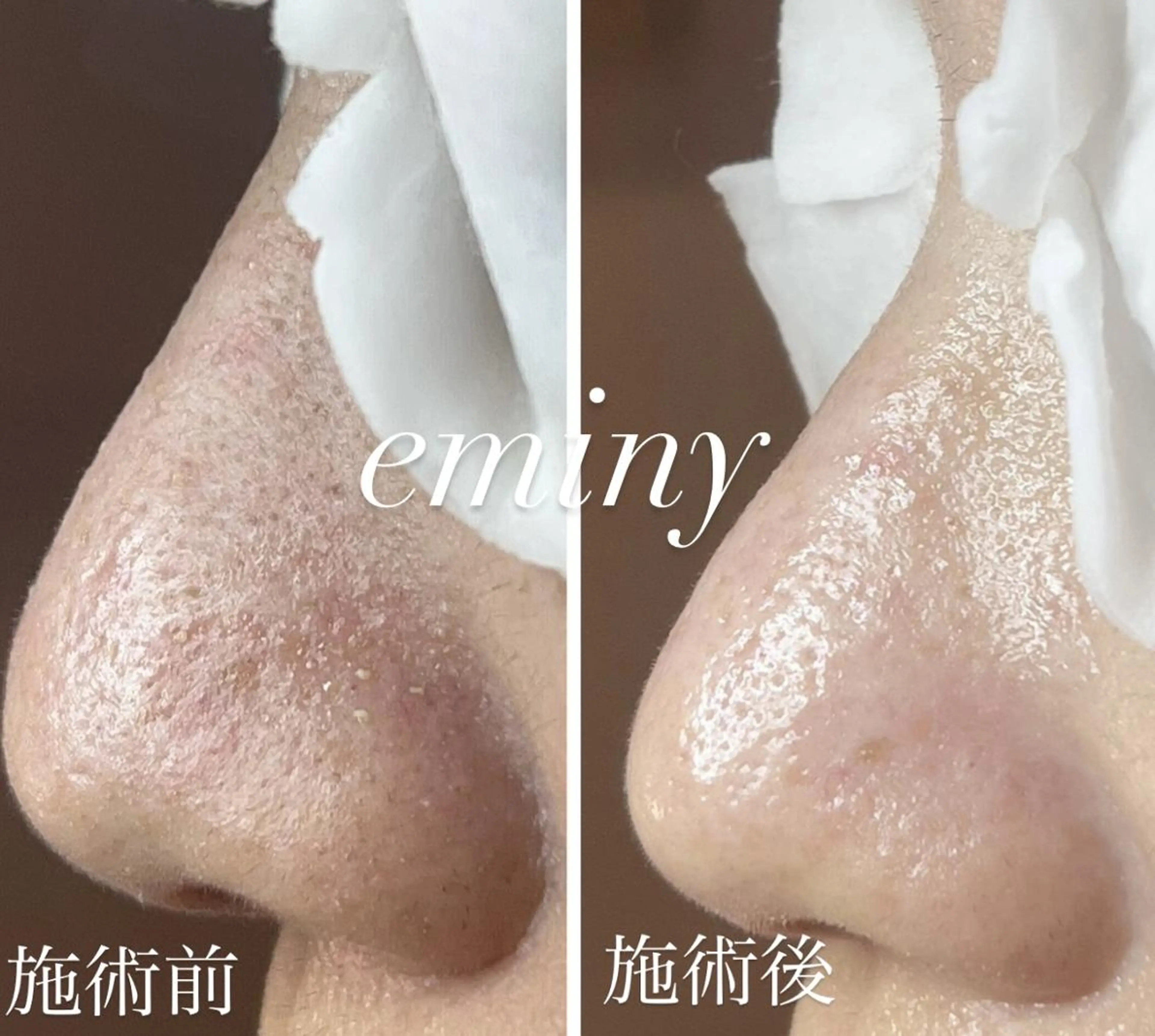 エステ リラク EMINY （エステティシャン）のエステ・リラクイメージ