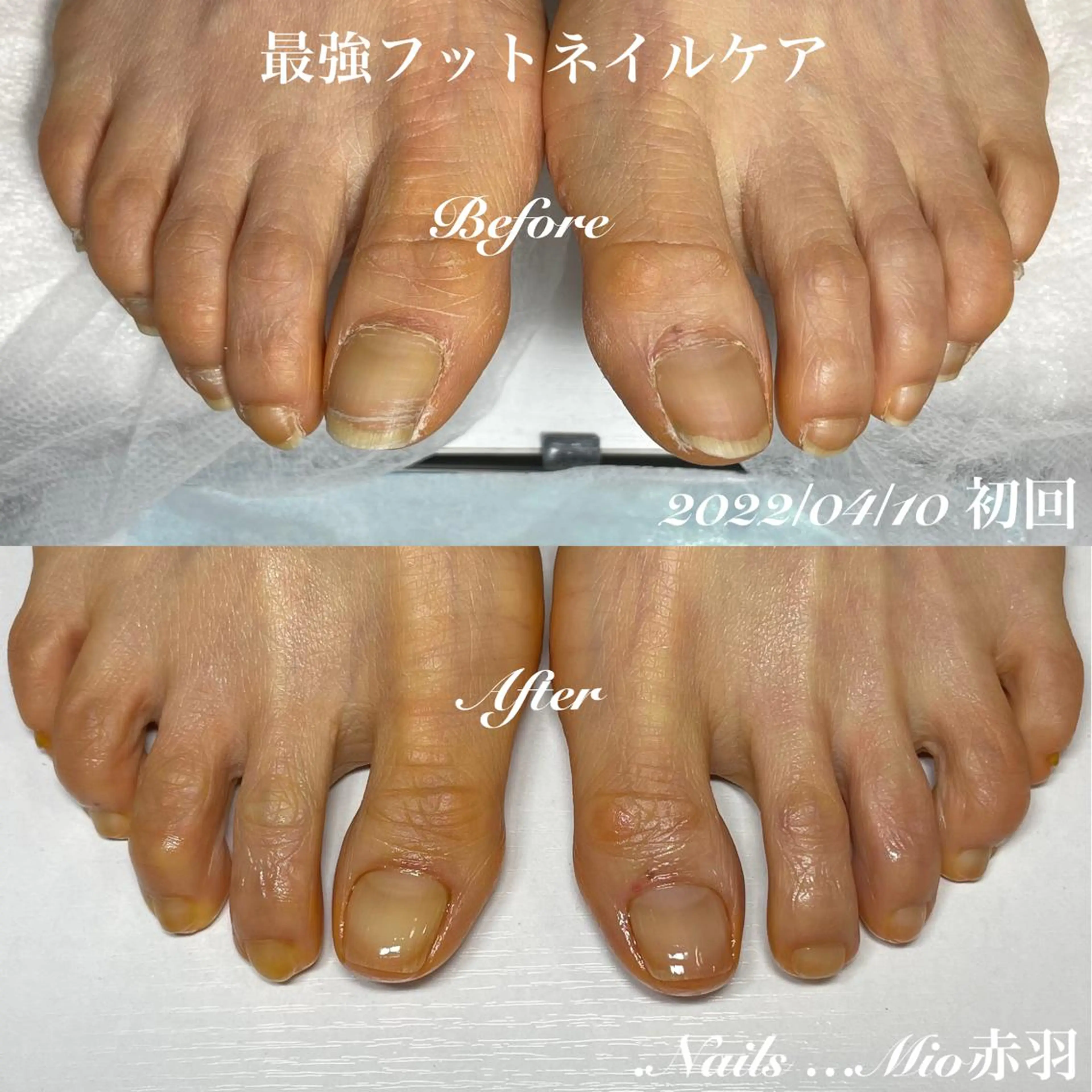 ネイル フットネイル .Nails Mio 赤羽西ネイルサロンのネイルデザイン
