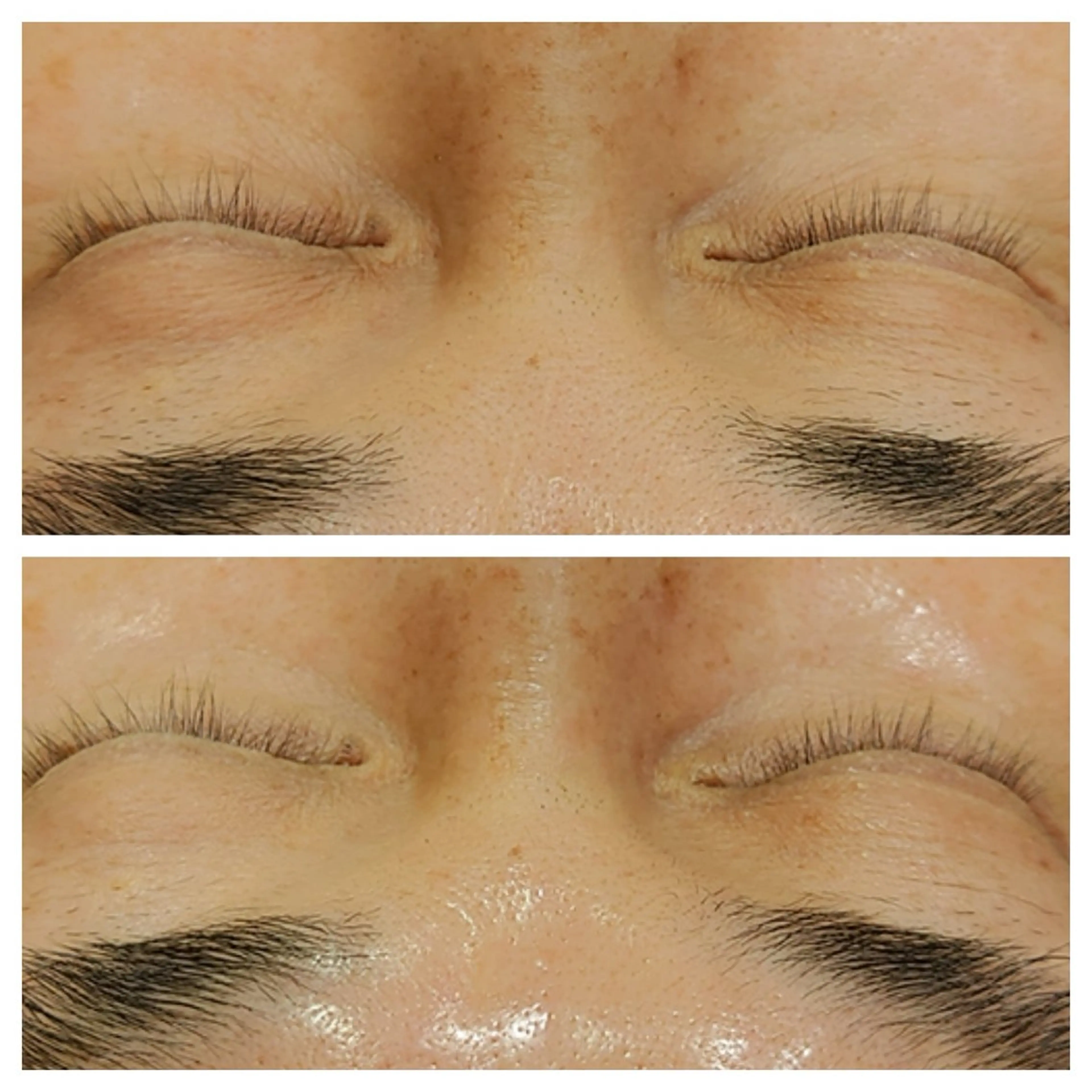 韓国式肌管理 ララピール専門のエステ・リラクイメージ