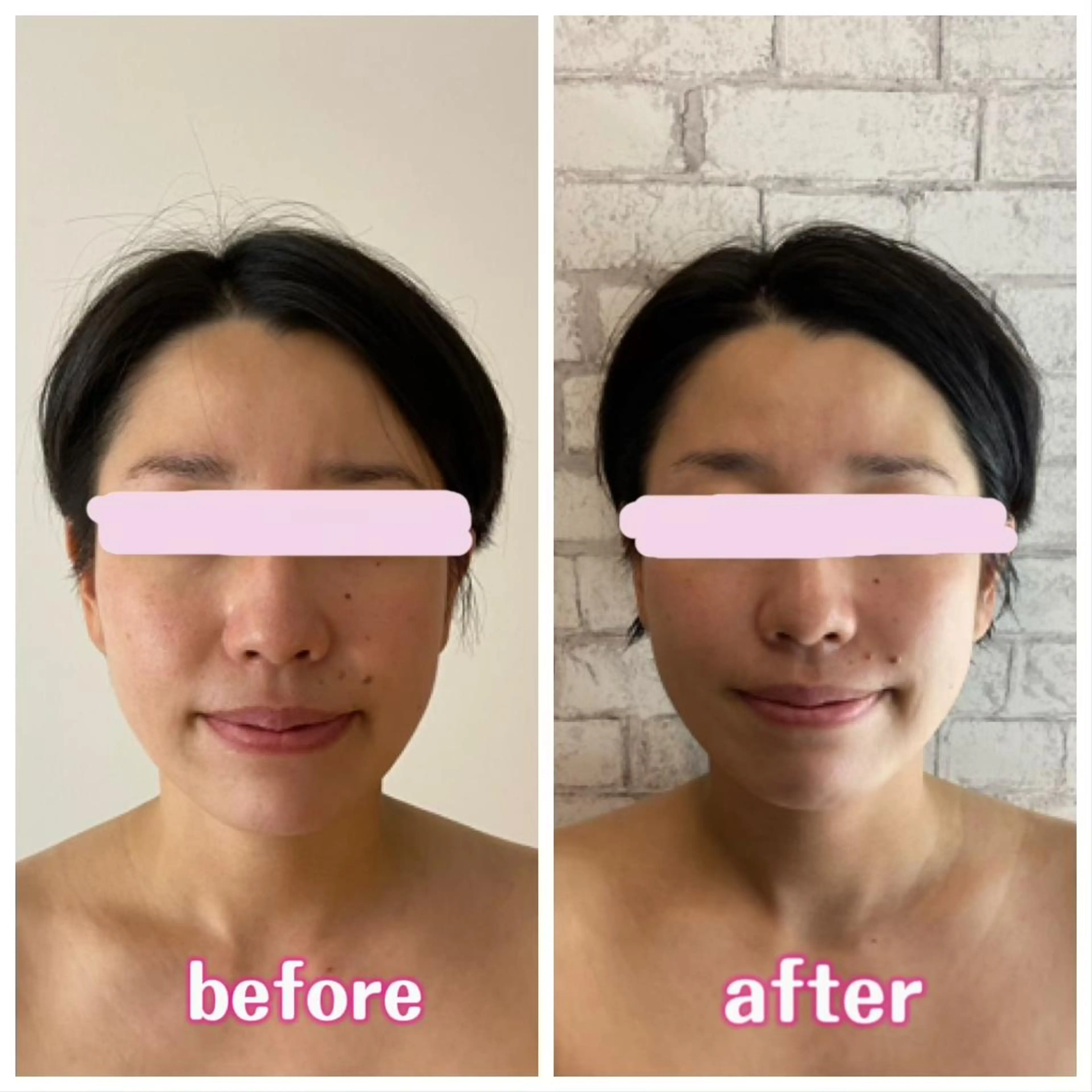 【小顔矯正】 salonaceのエステ・リラクイメージ