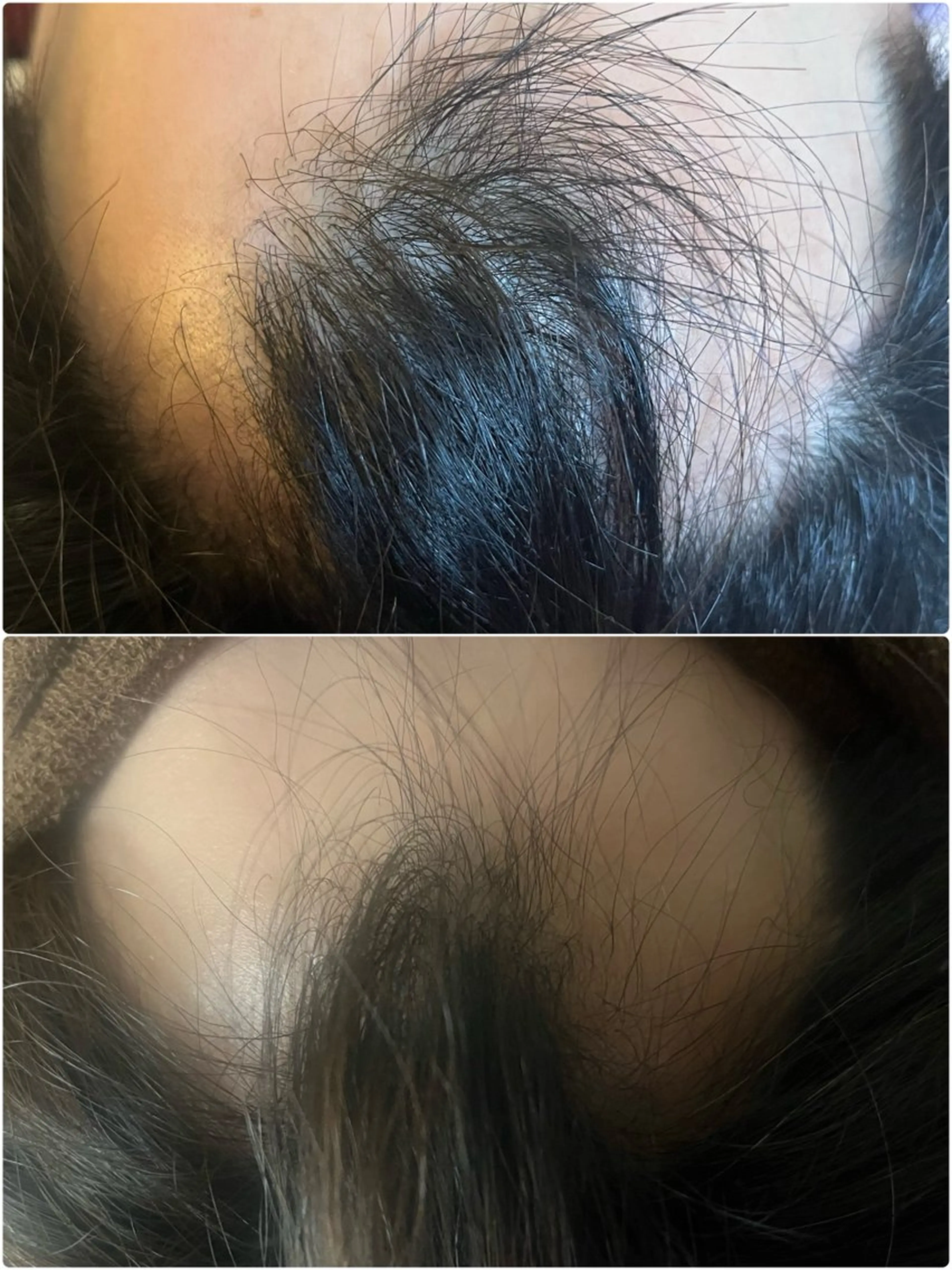 ヘッドスパ アロマ･美容鍼･カッ ピング「麗」鍼灸院のエステ・リラクイメージ