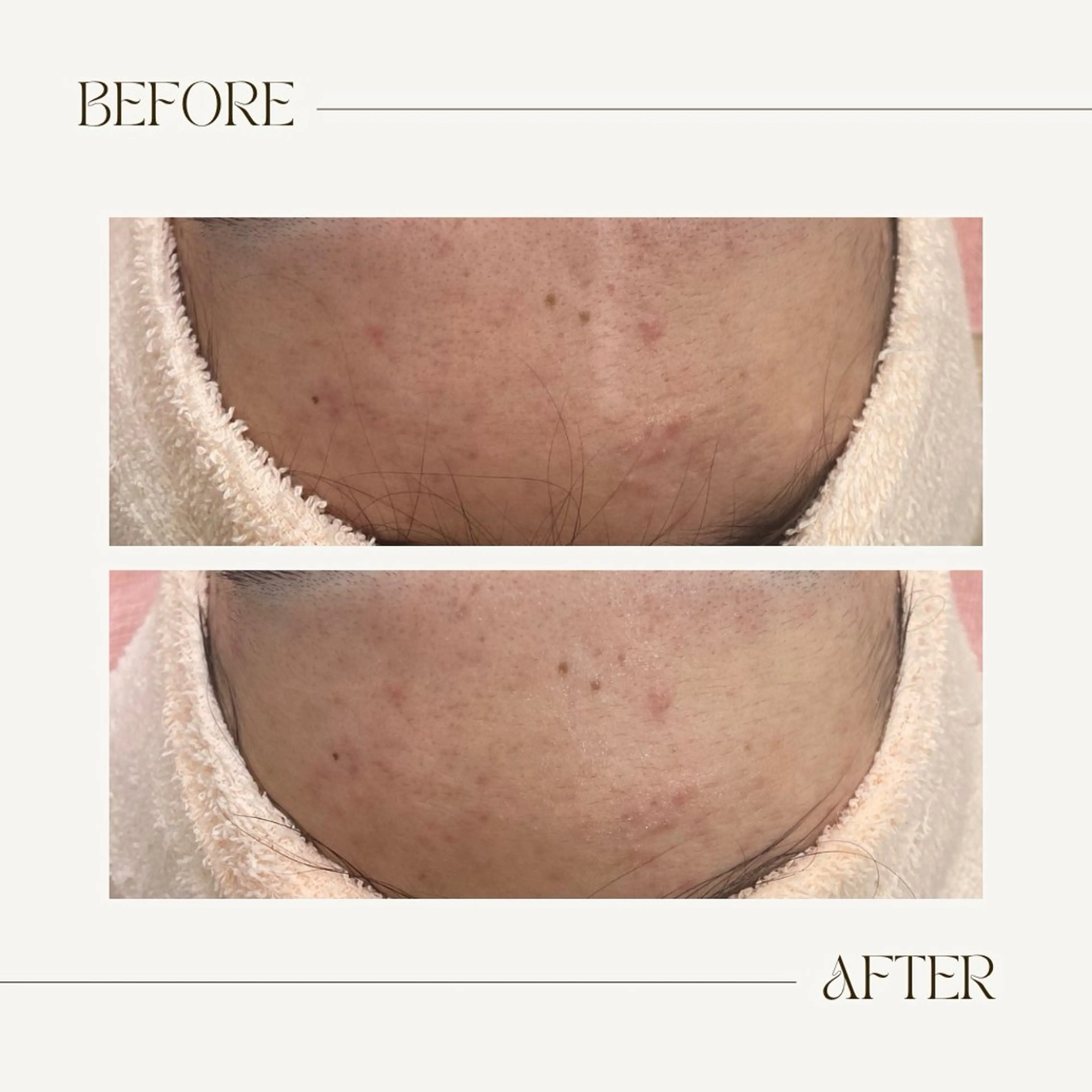 CEsalonEgg 齋藤のエステ・リラクイメージ