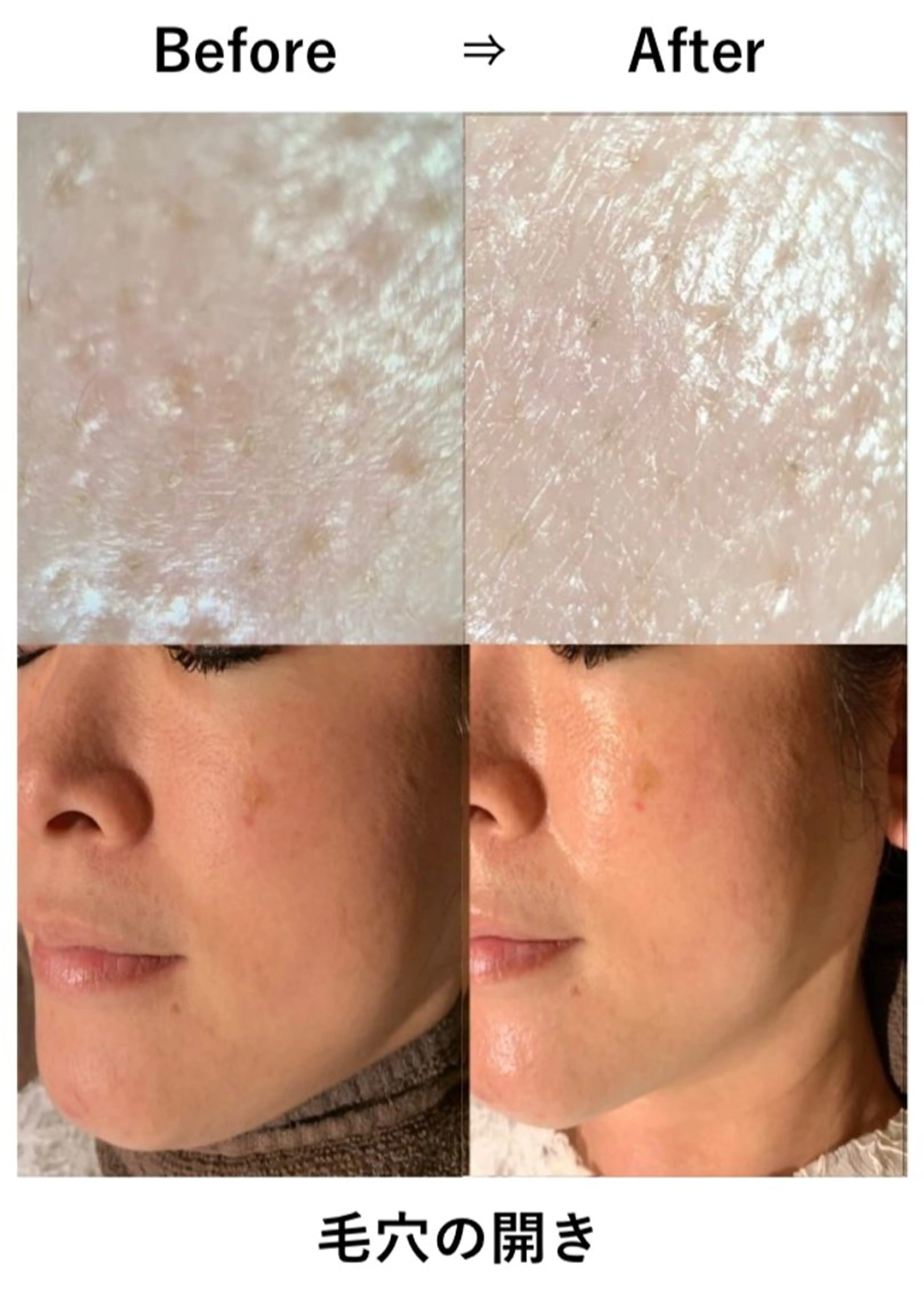 エステ solua Ayamiのマツエク・マツパデザイン