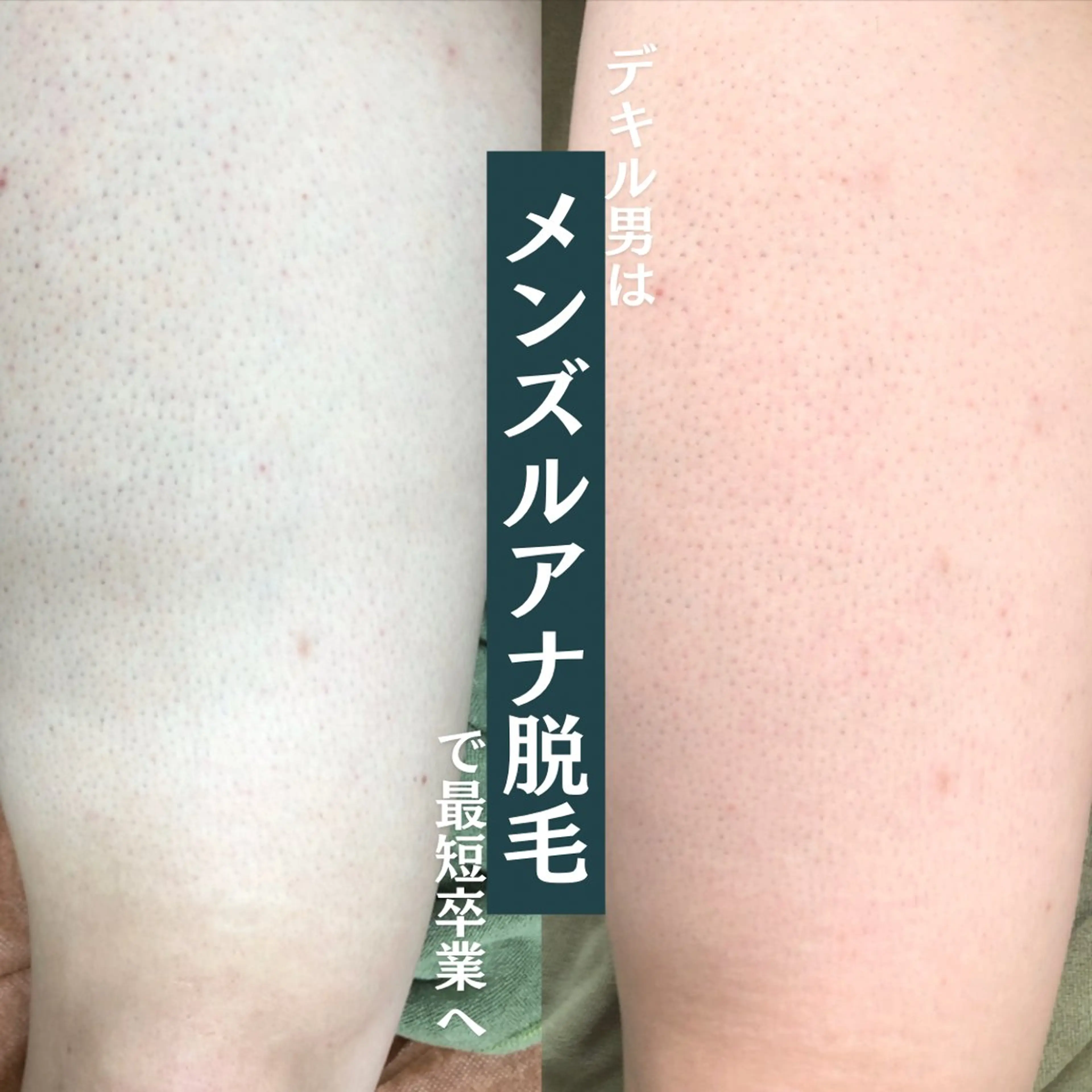 ルアナアイナ 大分のエステ・リラクイメージ