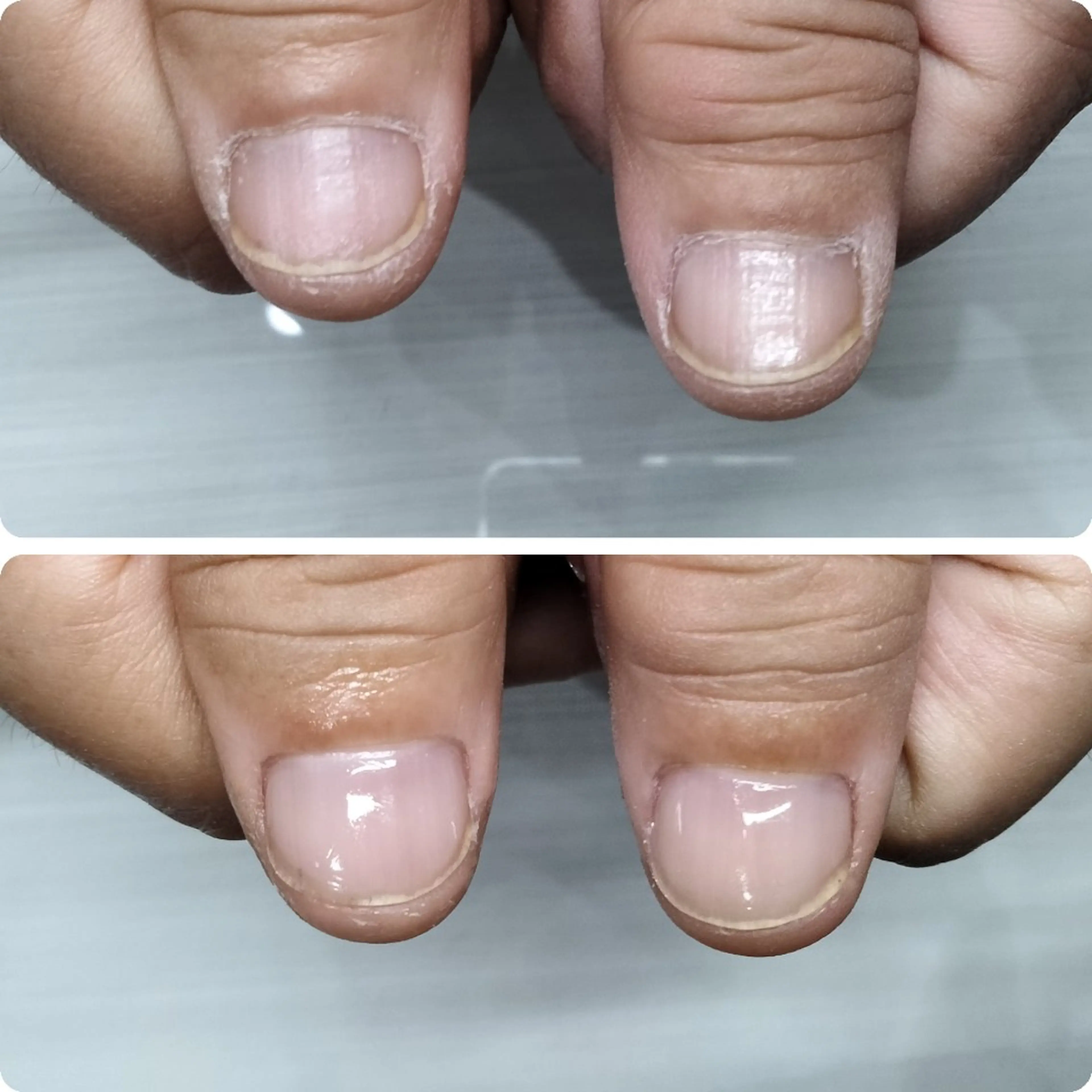 ネイル ネイルサロン アリュームのネイルデザイン