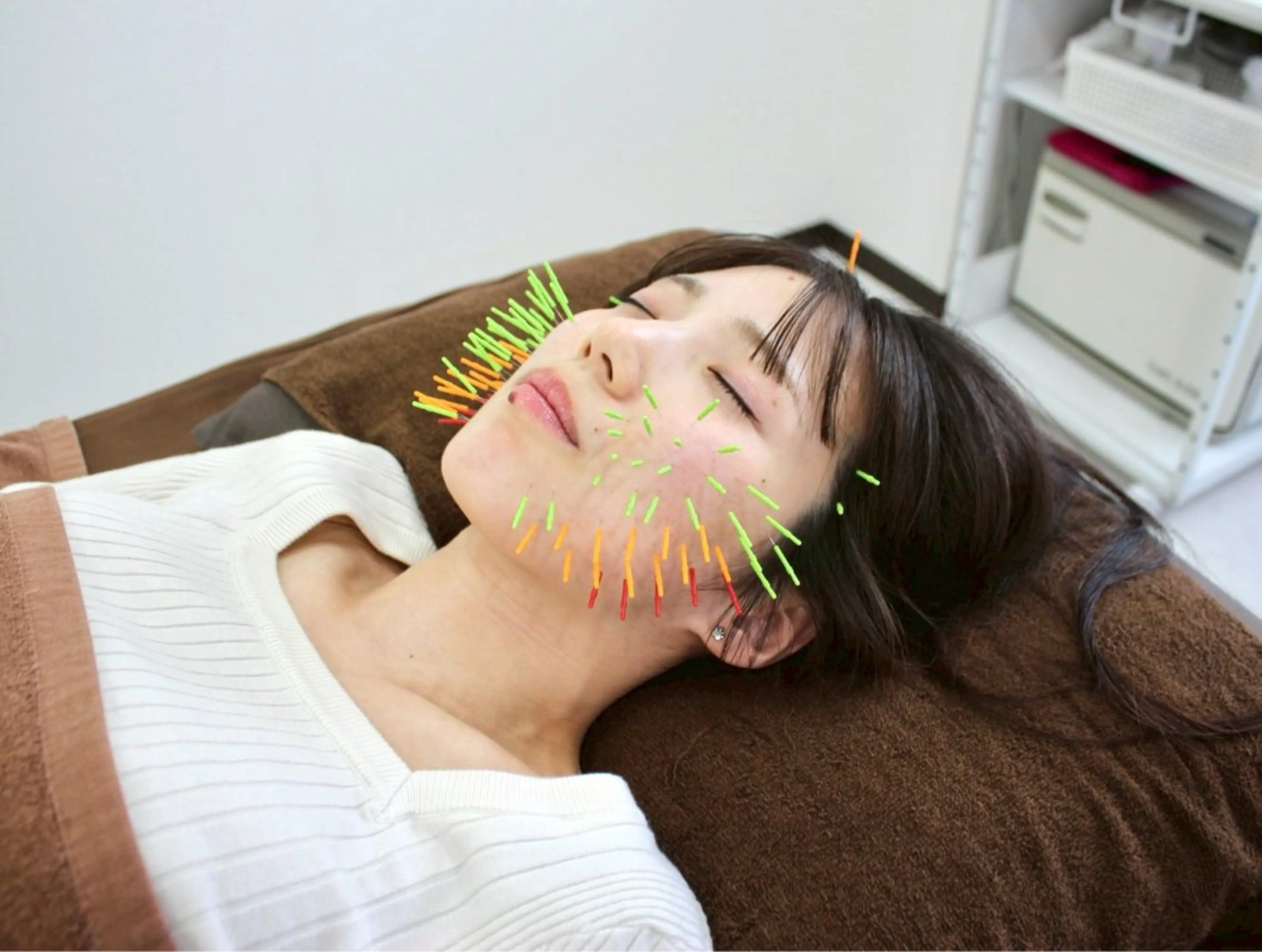 矯正整体＋百美鍼（90分）(猫背/肩こり/腰痛/小顔/リフトアップ/シワ/たるみ/毛穴/肌質改善/顔のむくみ)の写真