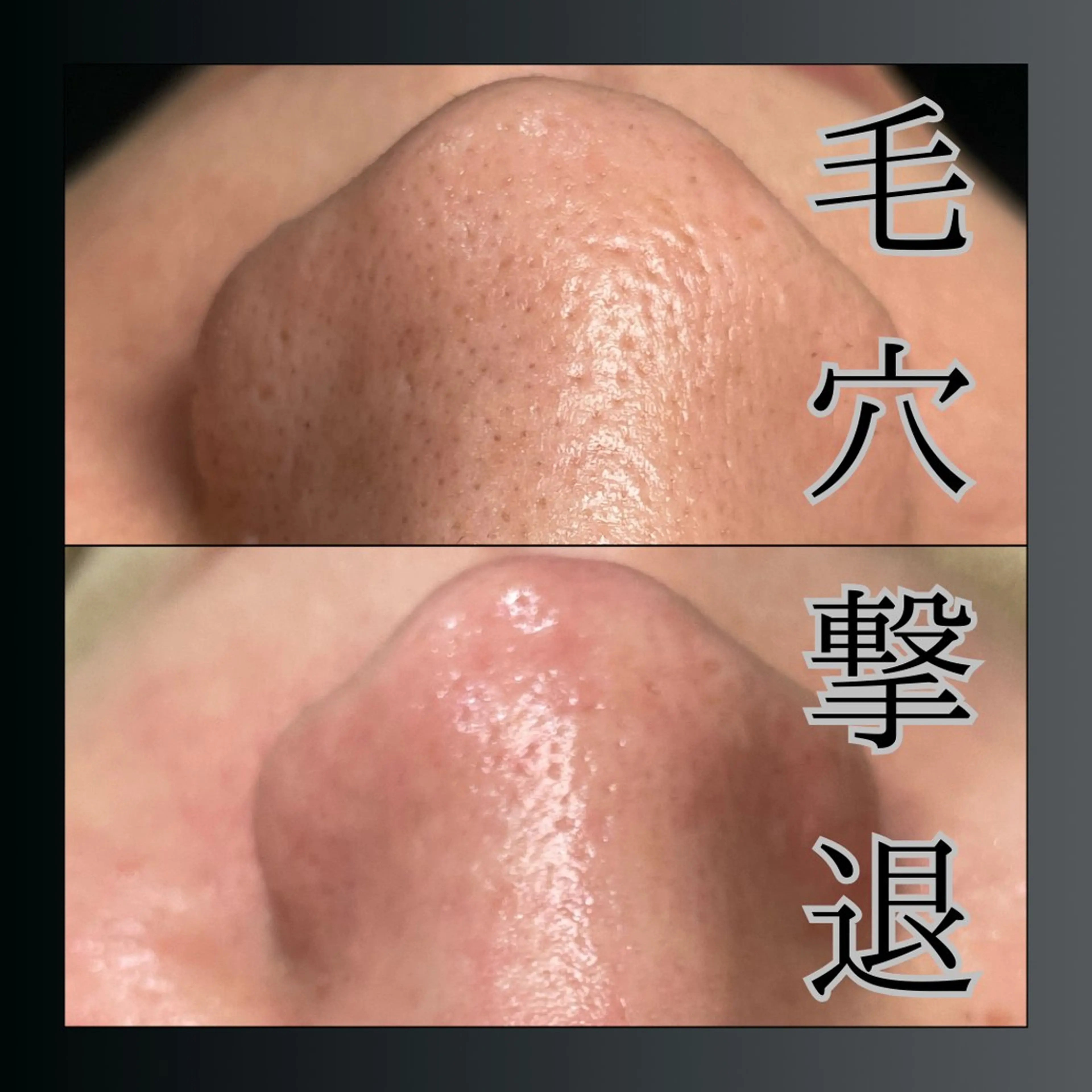 LiZA エステティックサロンのエステ・リラクイメージ