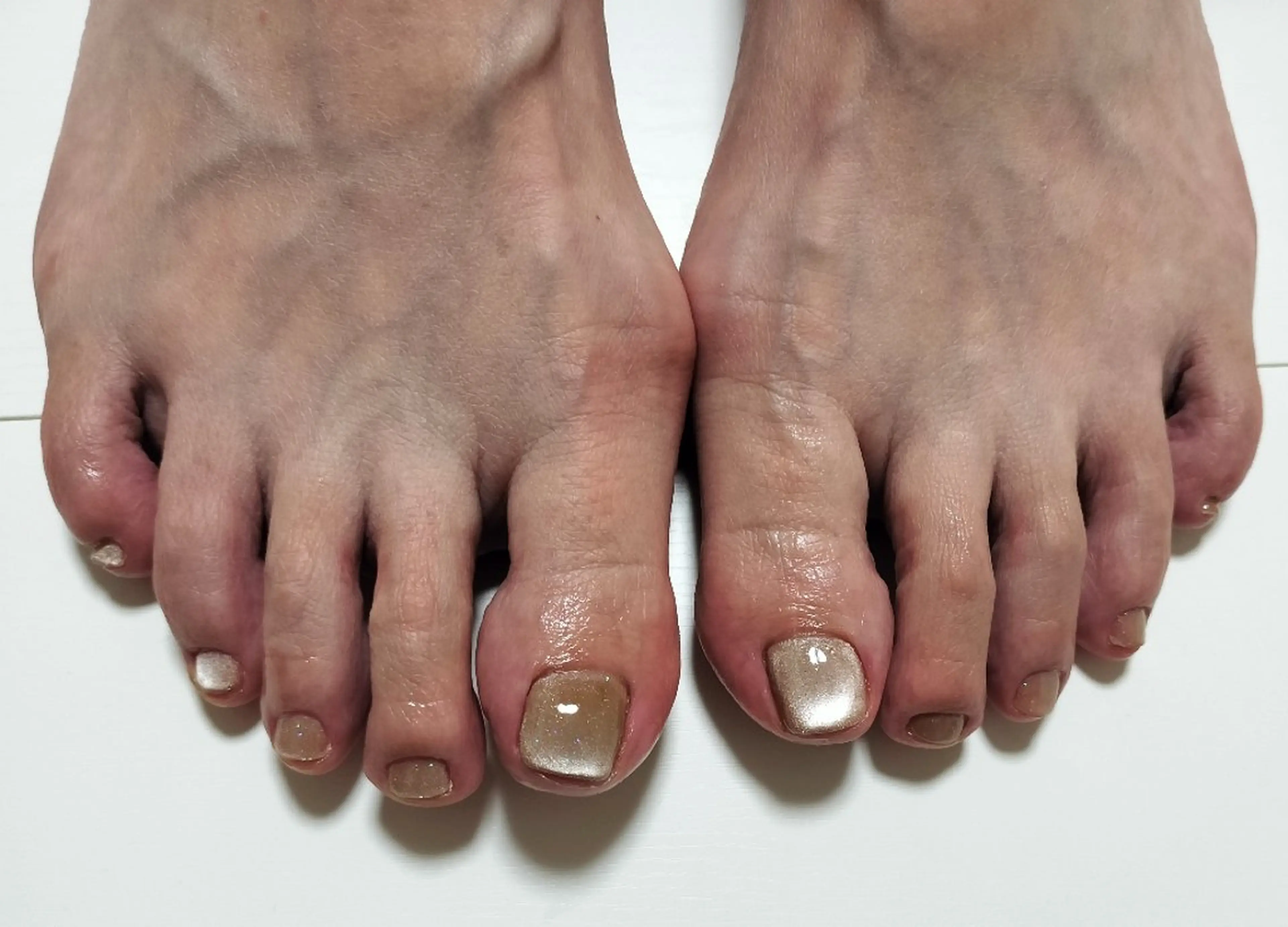 ネイル フットネイル inhernail hitomiのネイルデザイン