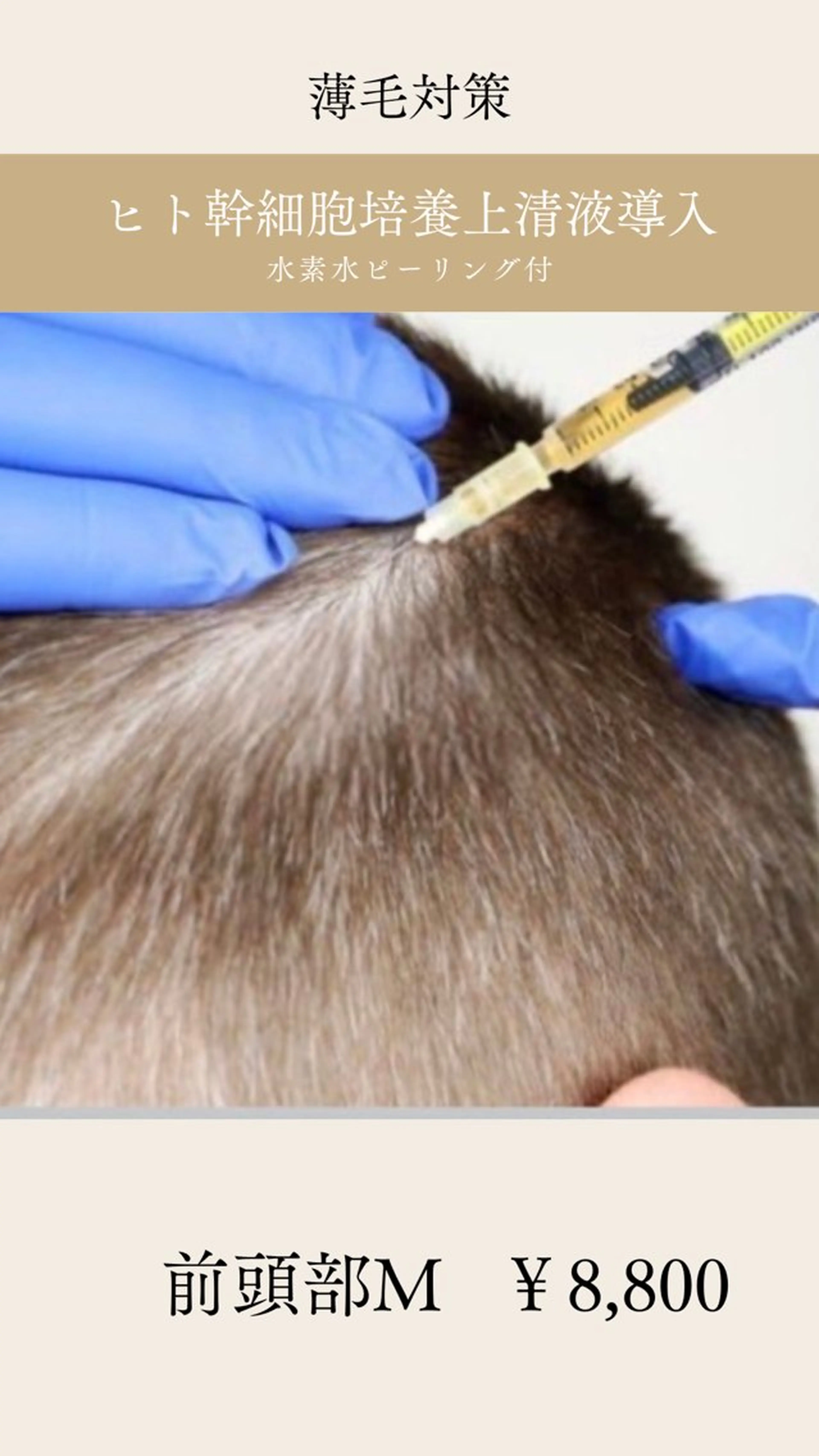 メンズ 井上 みあのエステ・リラクイメージ