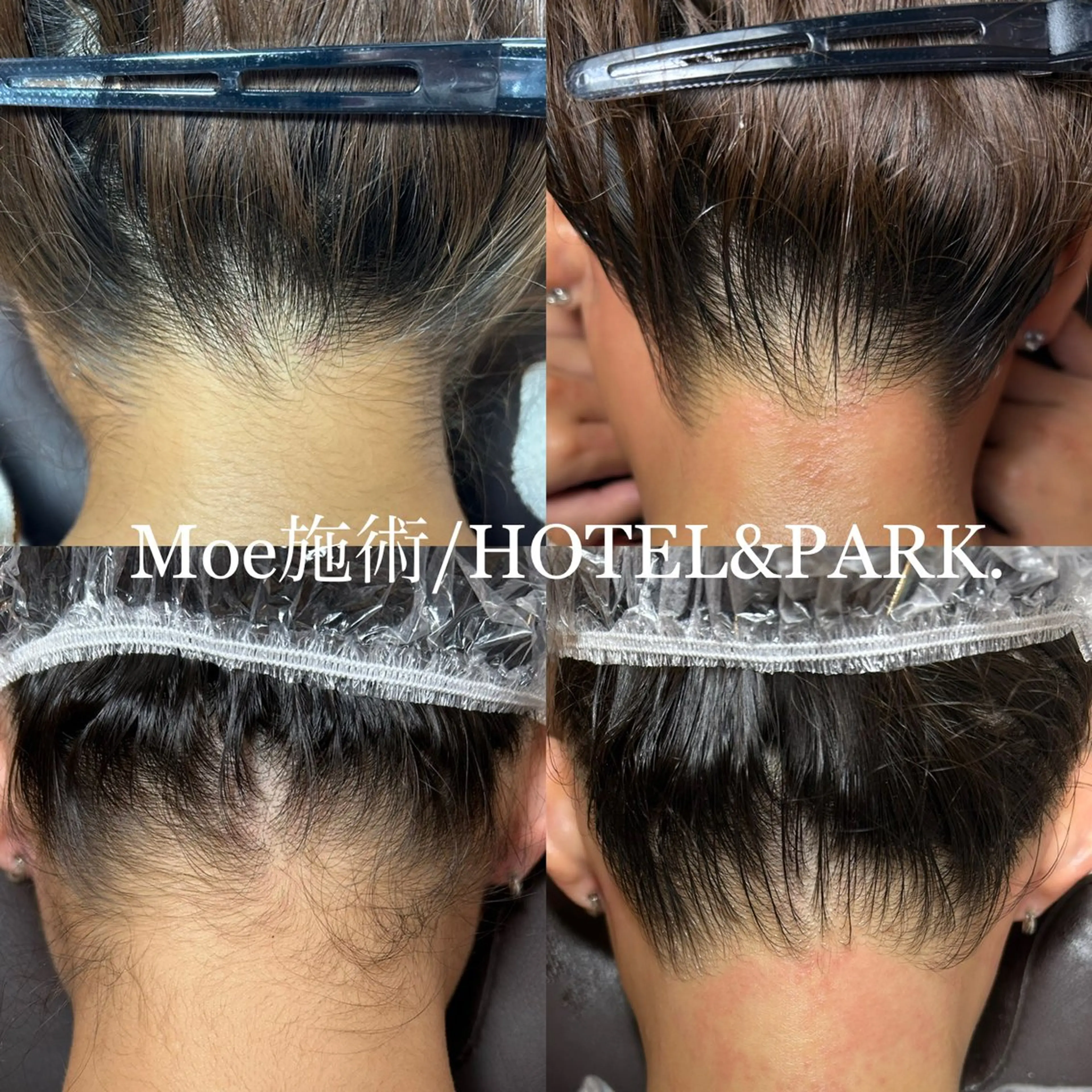 HOTEL&PARK .Moeワックス脱毛のエステ・リラクイメージ