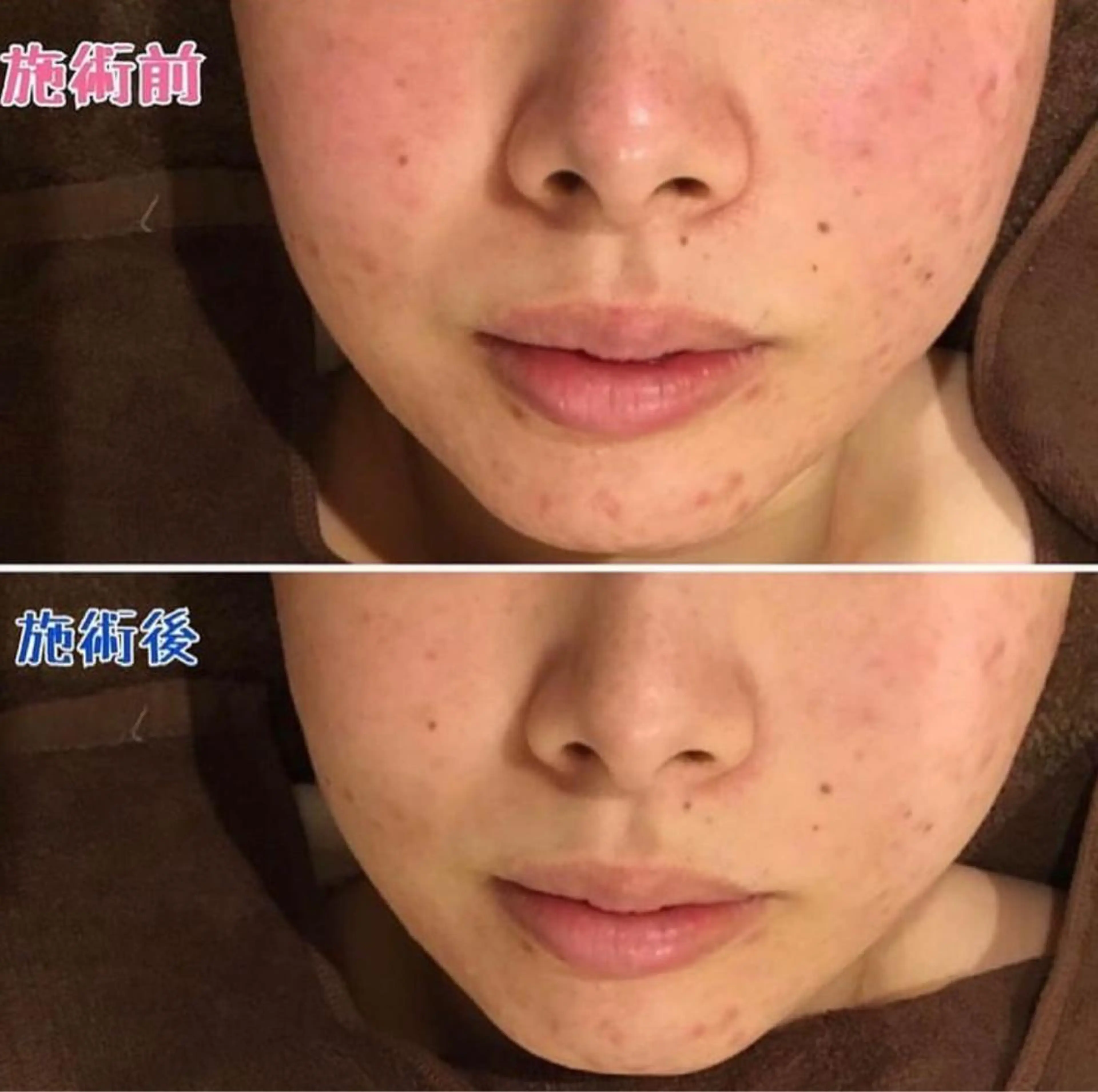 脱毛 ULULU 上野店のエステ・リラクイメージ