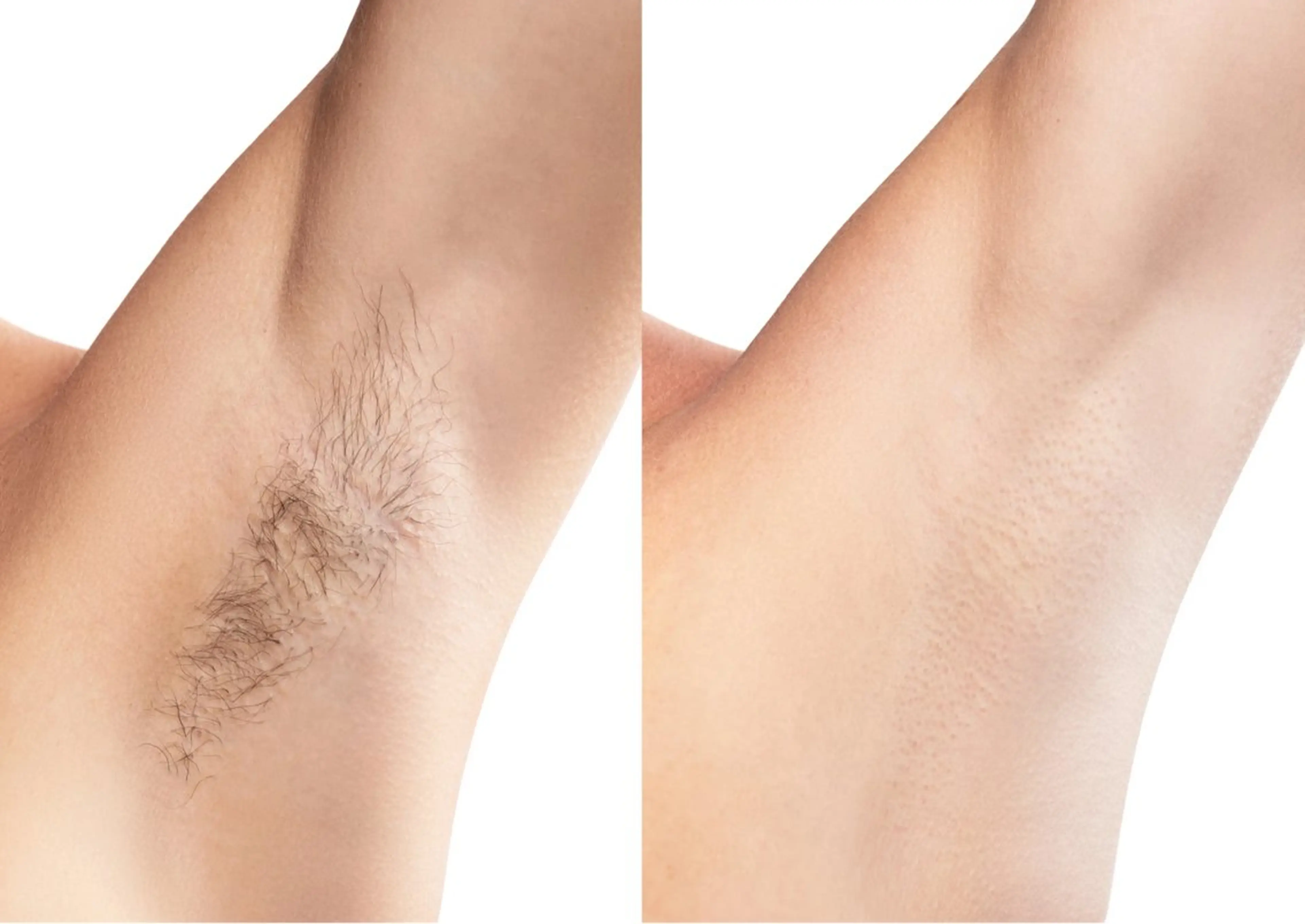 脱毛 A"-HILU （アーヒル)のエステ・リラクイメージ