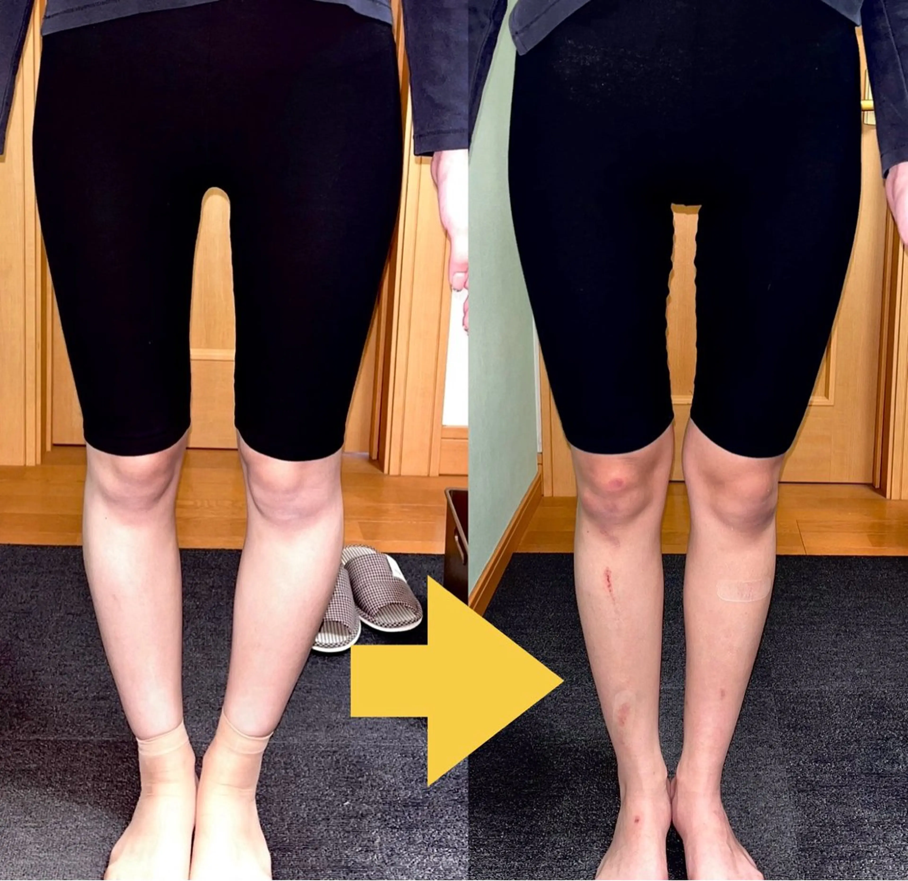 【Ｏ脚、Ｘ脚でお悩みの方向け】★minimo初回限定★ O.X脚矯正　60分　⤴️美脚◎の写真