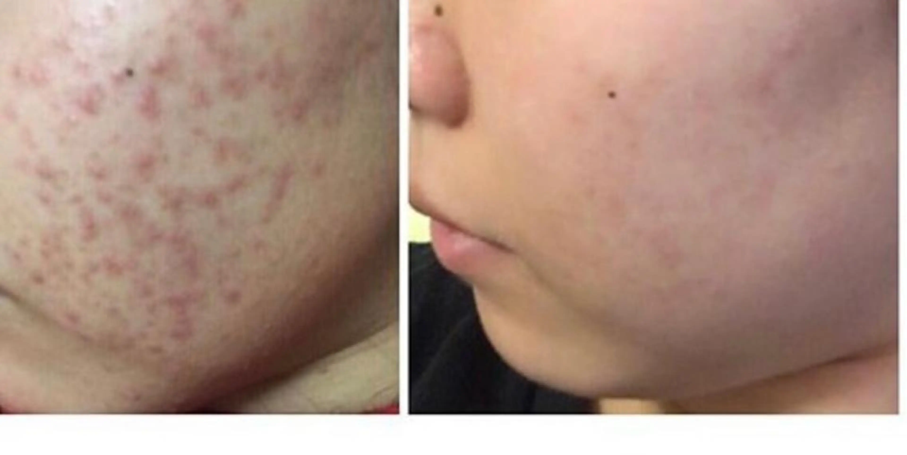 朝重い人専用 肩甲骨調整のエステ・リラクイメージ