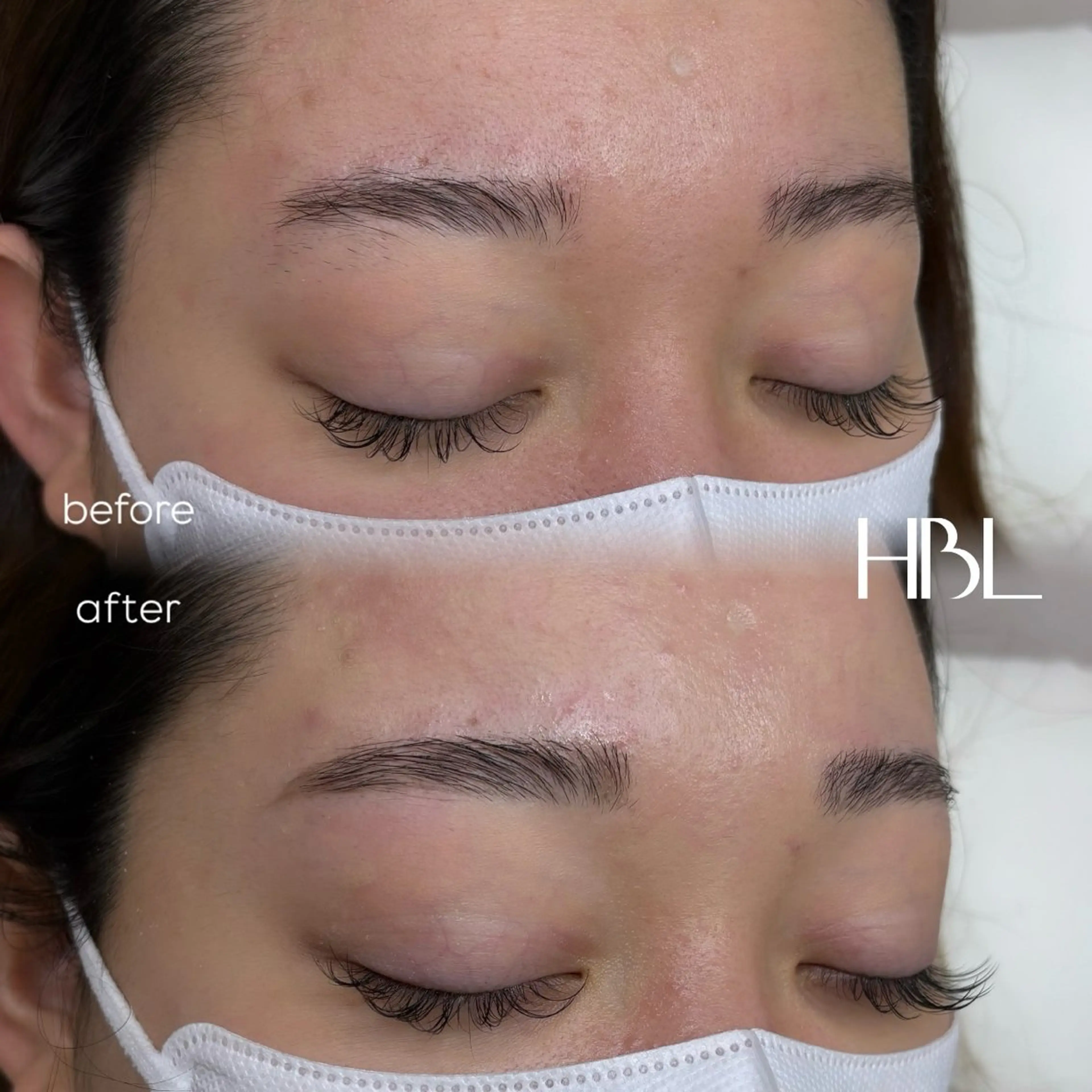 新HBL ✨️ 先着 30名❣️モニター価格の写真