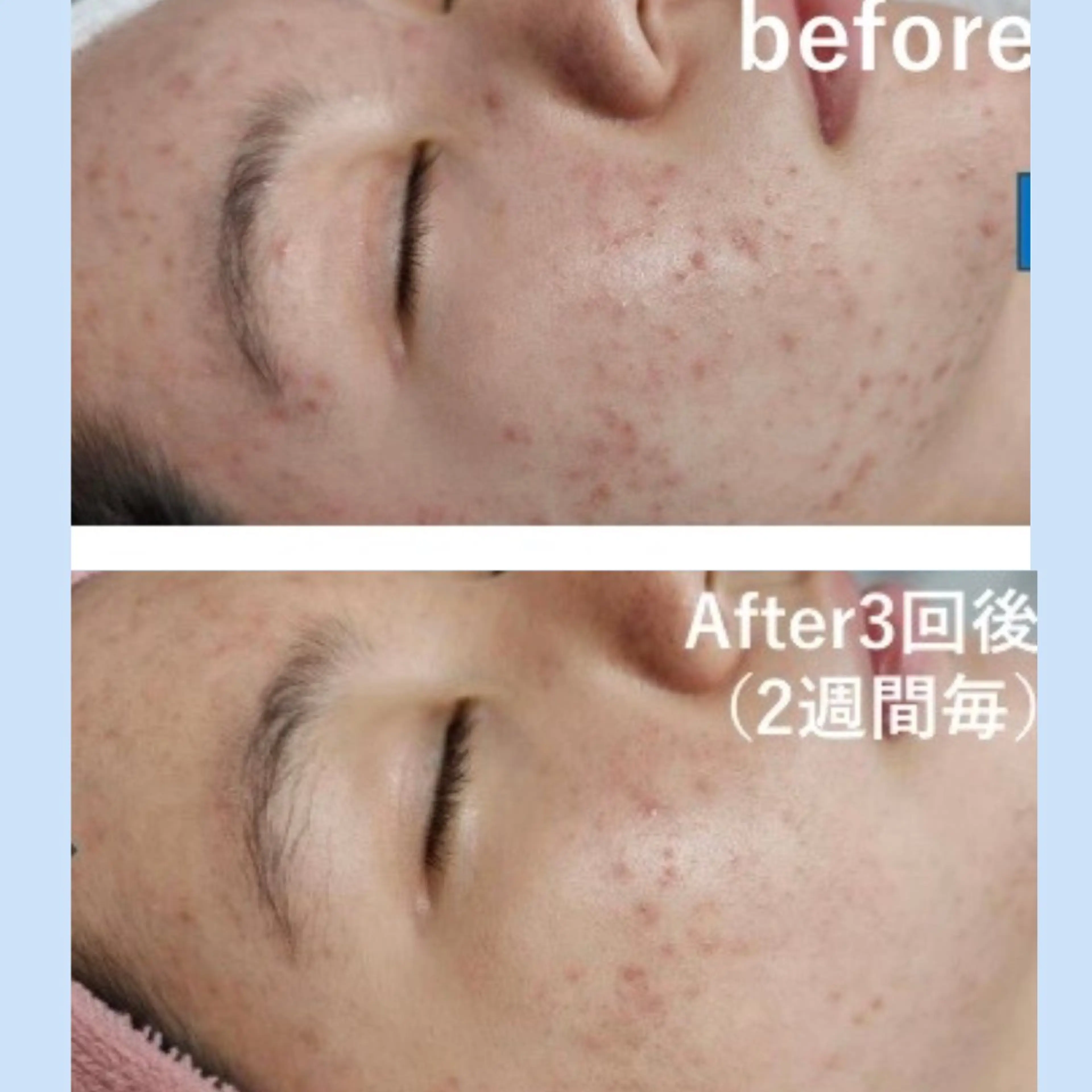 エステ 光フェイシャル・脱毛 MIA.ROSAのエステ・リラクイメージ