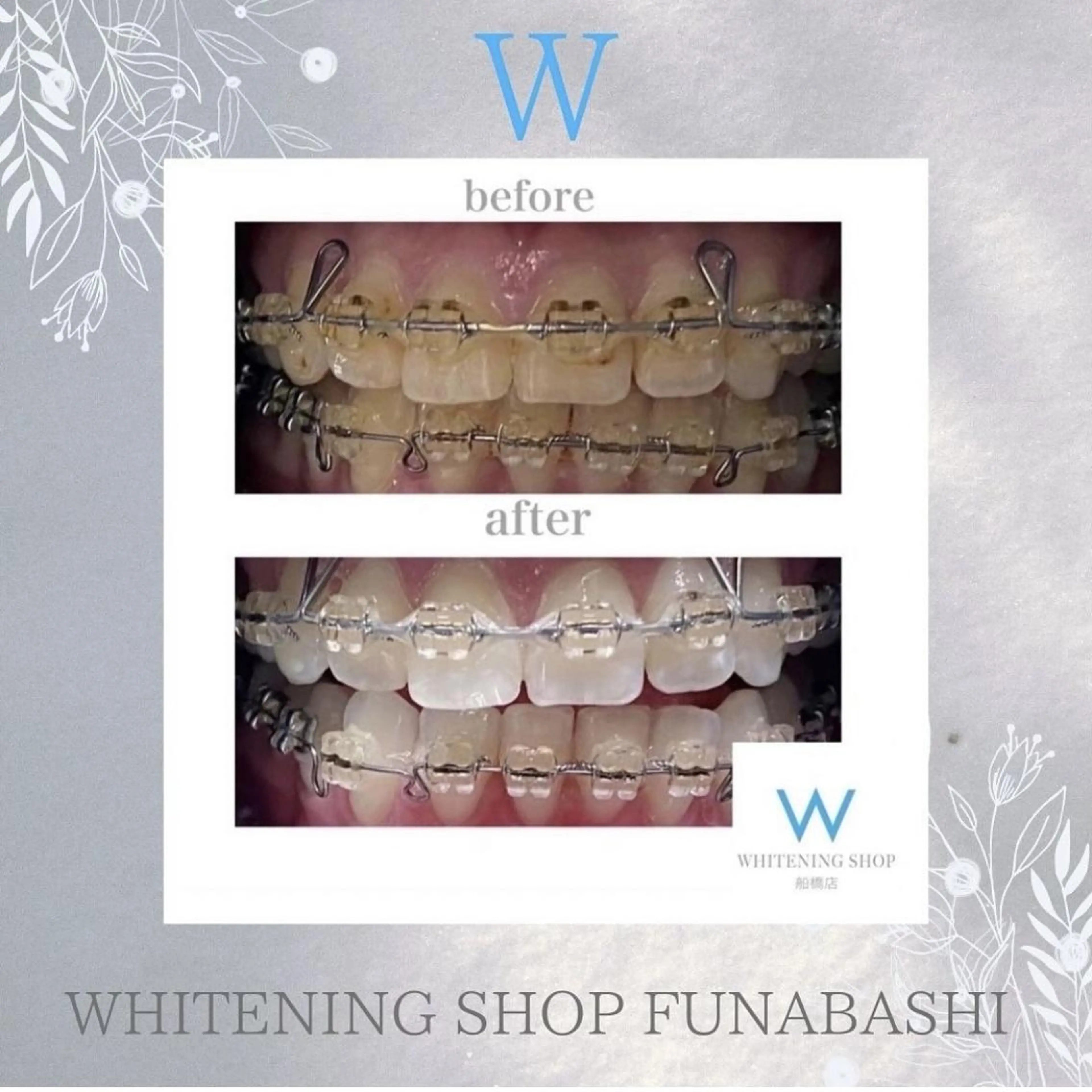 メンズ エステ リラク ホワイトニング ショップ船橋２号店のエステ・リラクイメージ