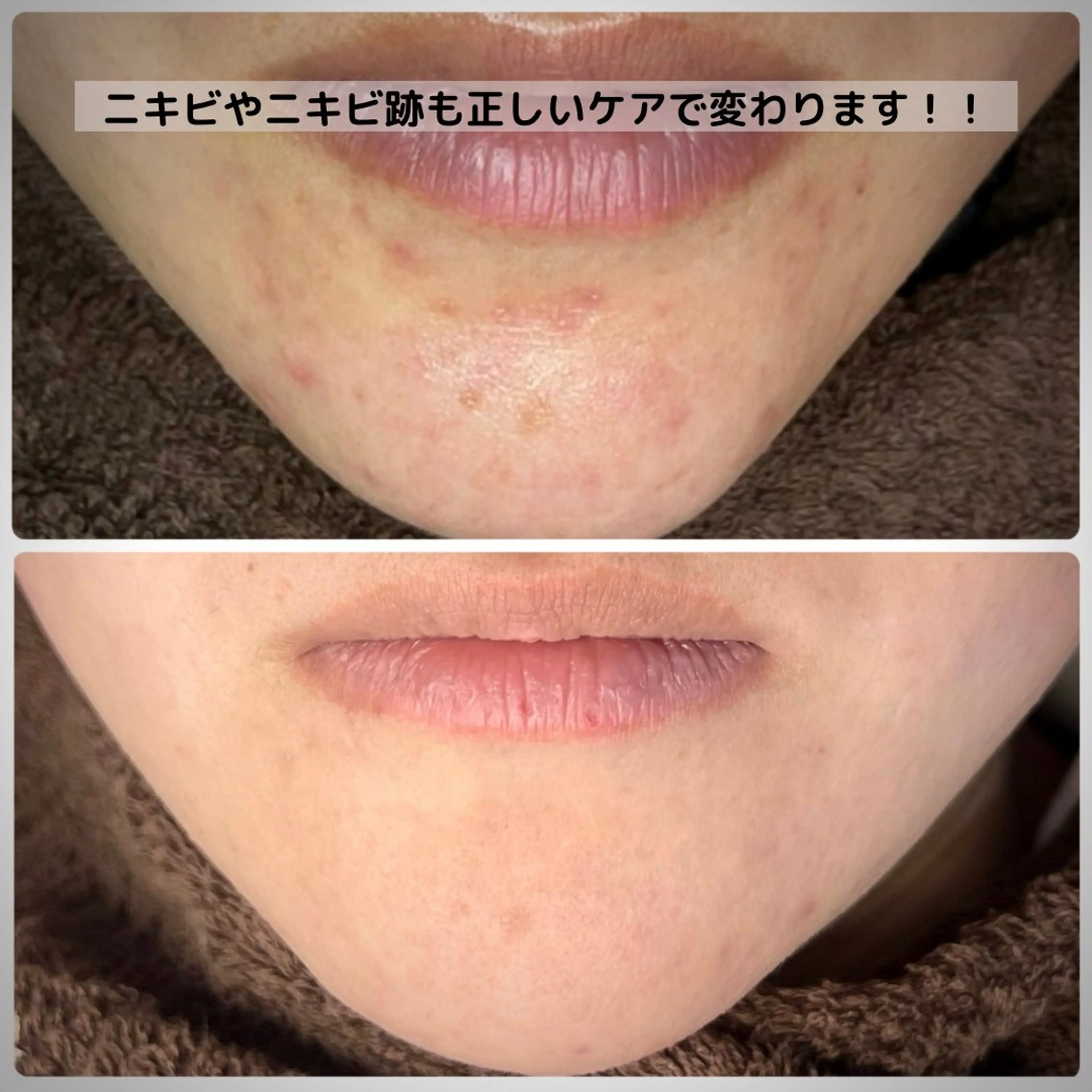 Muqu. 毛穴サロンのエステ・リラクイメージ