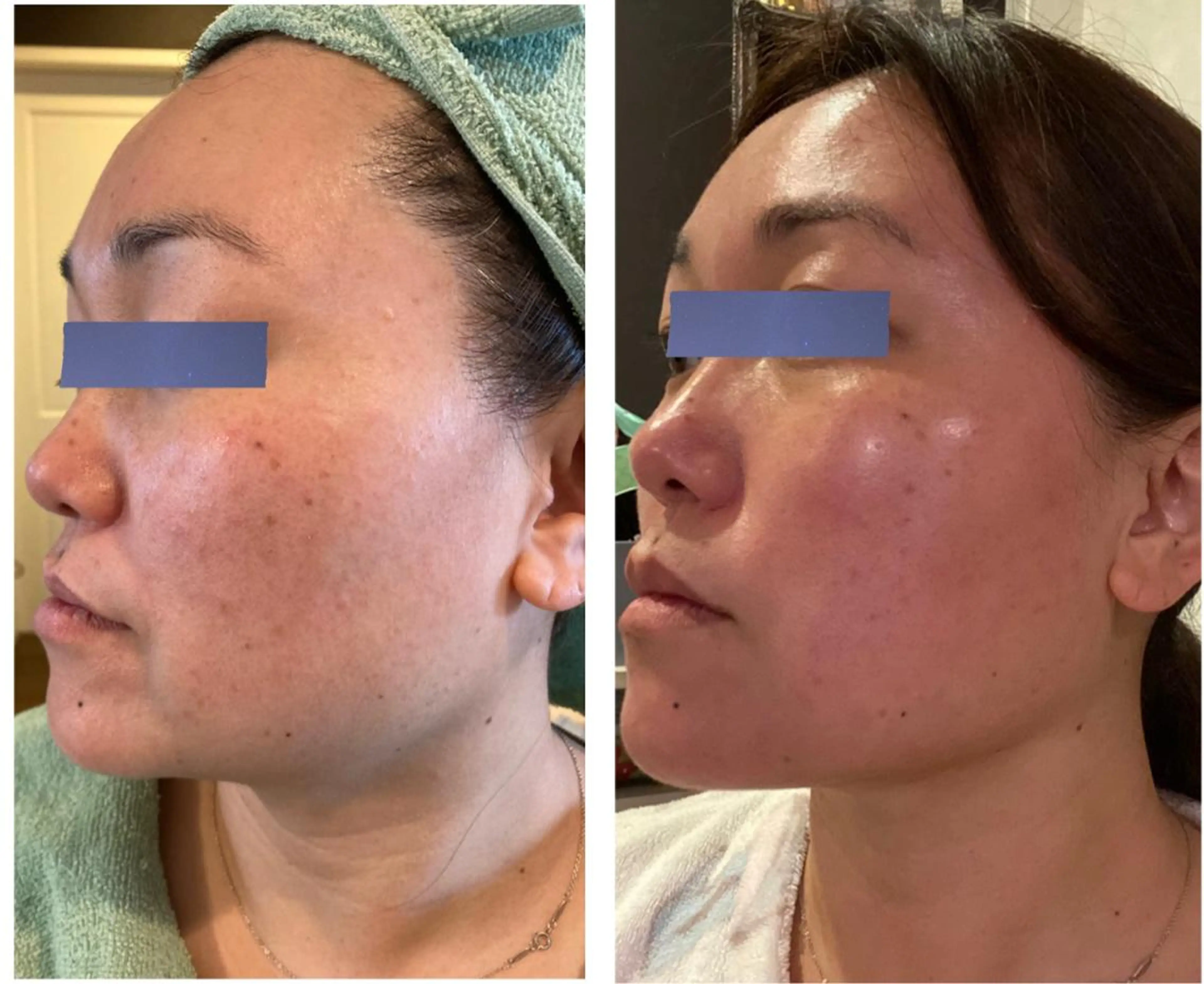 フェイシャルサロン N +〜エヌプラス〜のエステ・リラクイメージ