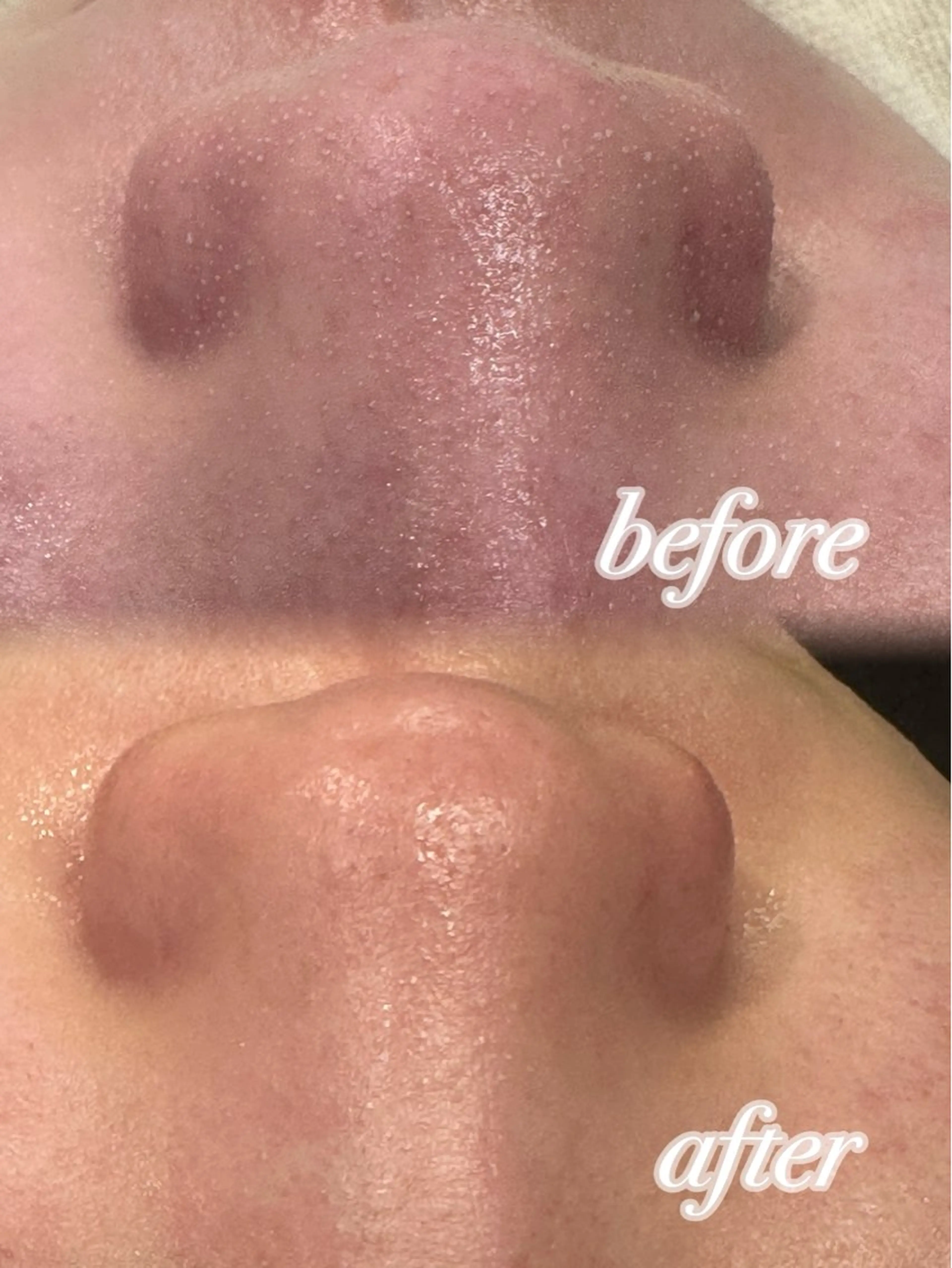 ぷる艶肌🫧 shaving斉藤のその他イメージ