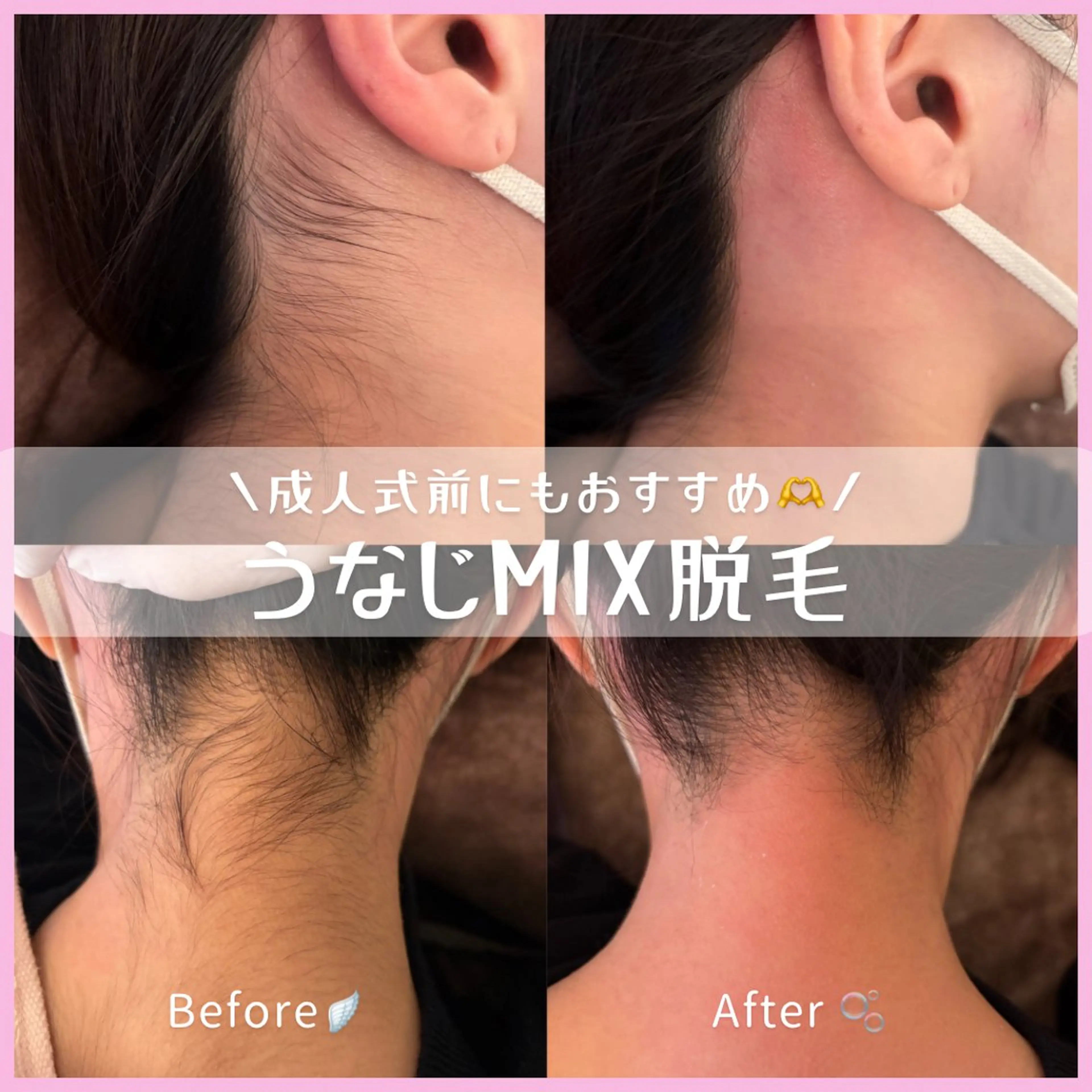 脱毛サロン COCOKANAの眉毛・アイブロウイメージ