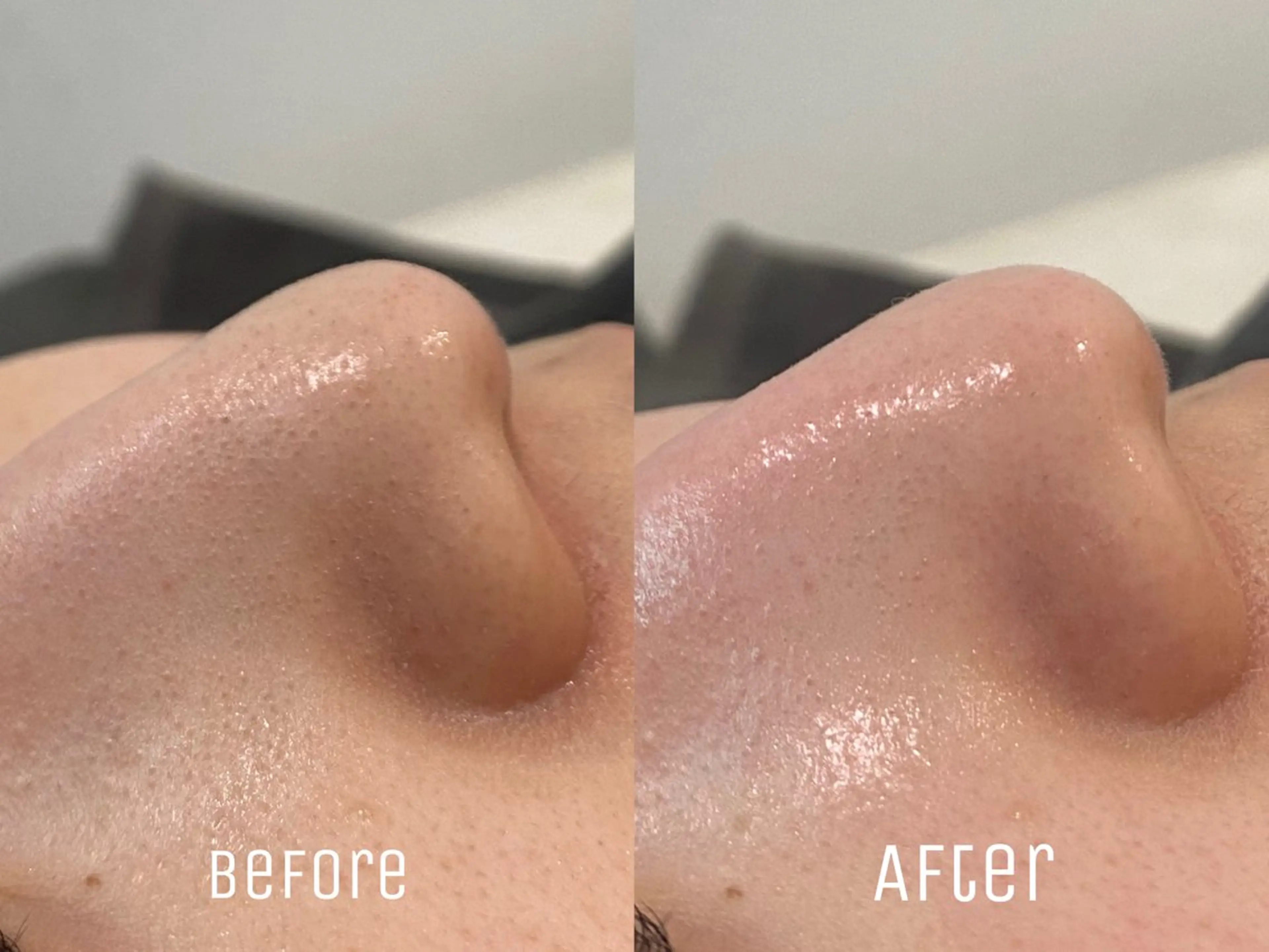 エステ ニキビ・毛穴・肌荒れ &me 西宮北口店のその他イメージ