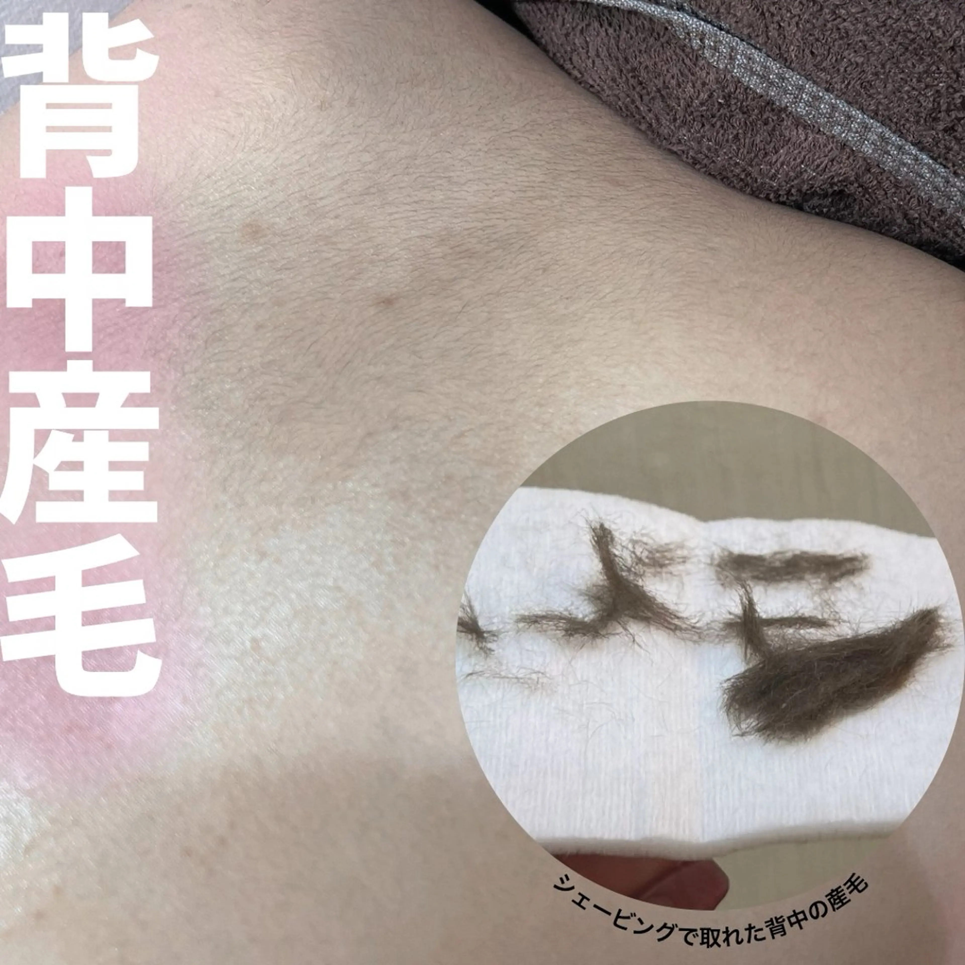 背中ワックス脱毛👗つるんと背中美人の写真