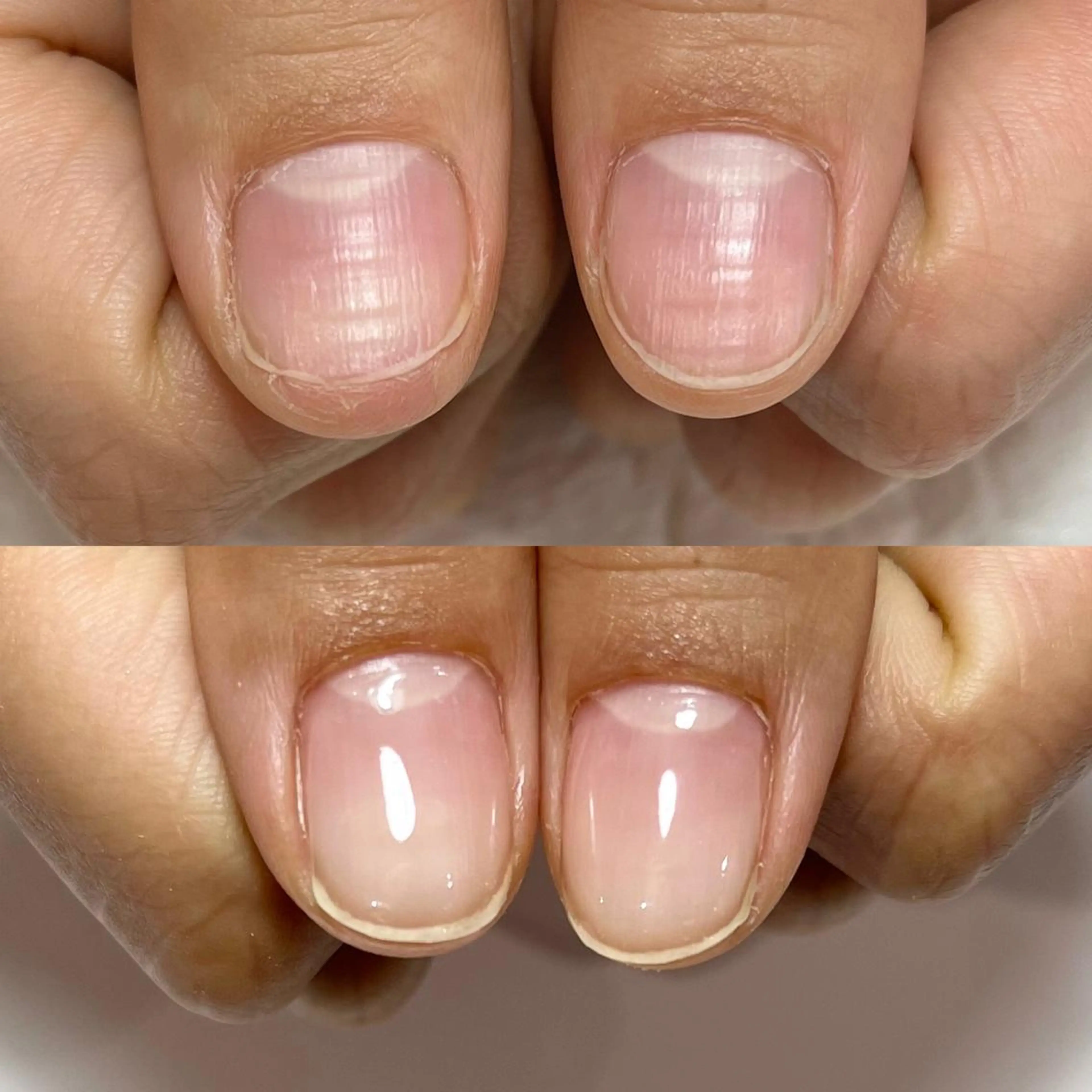 ネイル 自爪育成・巻き爪 補正講師　津蔵のネイルデザイン