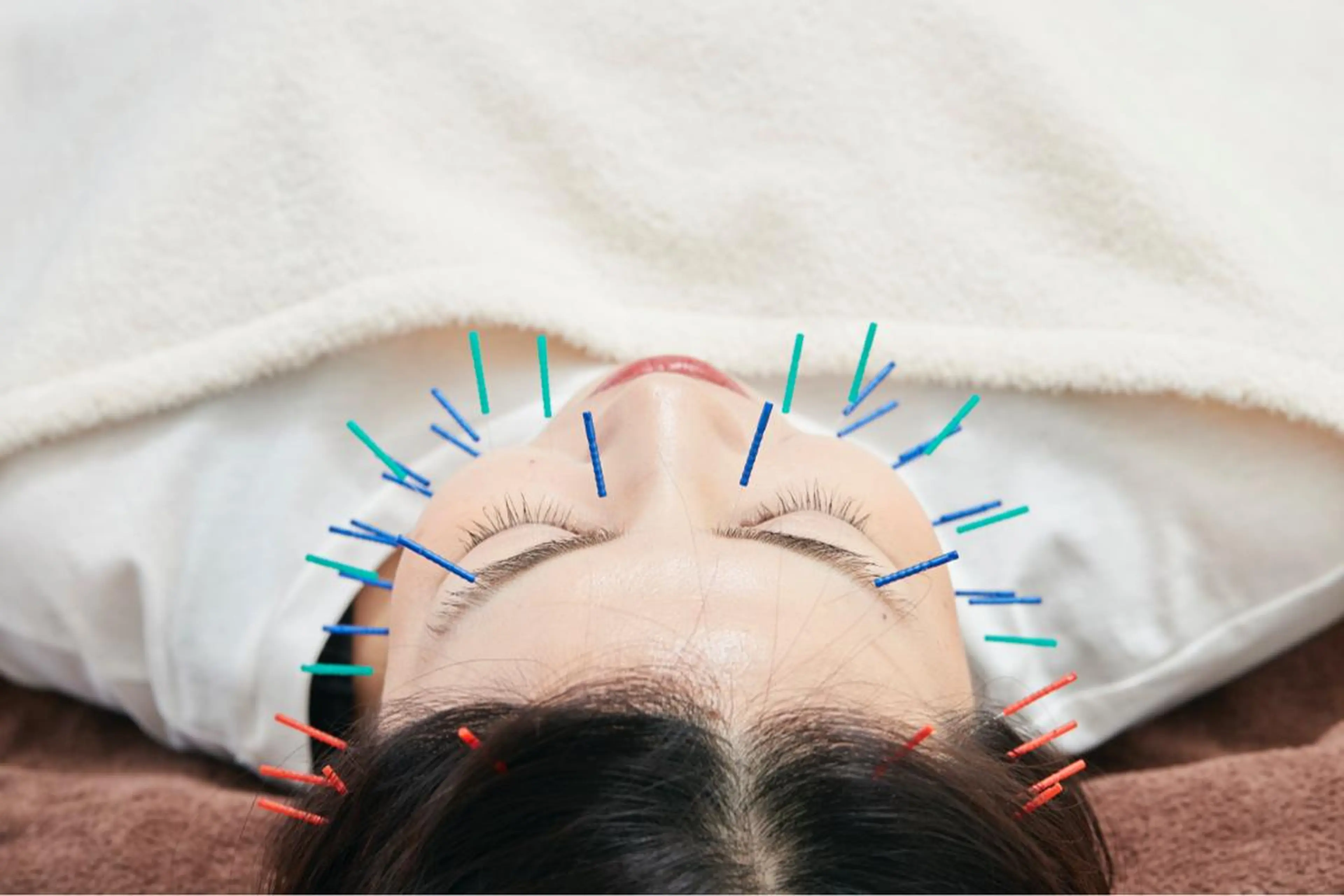 【minimo限定】目元集中ケア(クマや目の下のたるみを改善・予防、目パッチリ)鍼30本程＋目元パック🪡🫧の写真