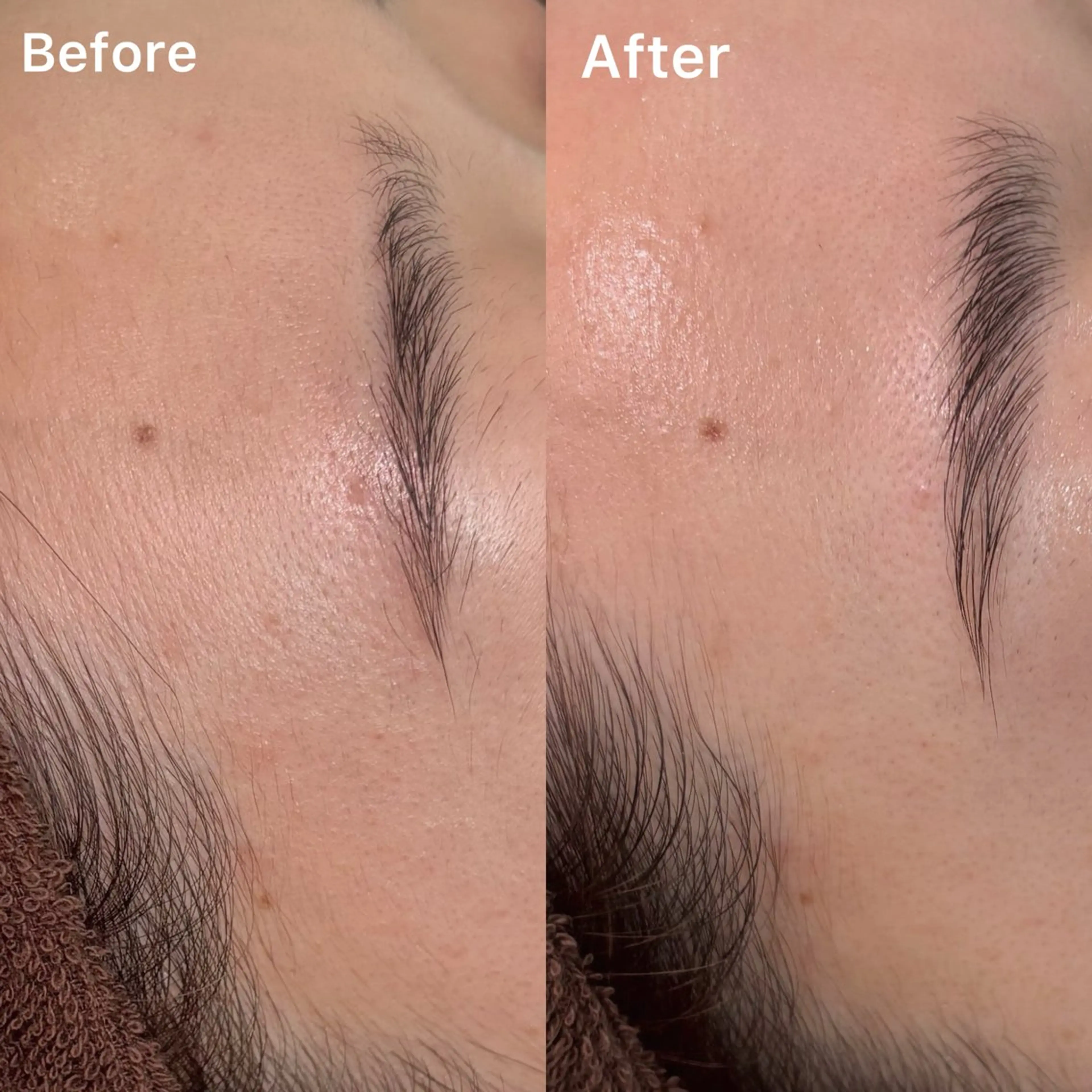 HBL+お顔剃り(フェイスシェービング)💎✨の写真