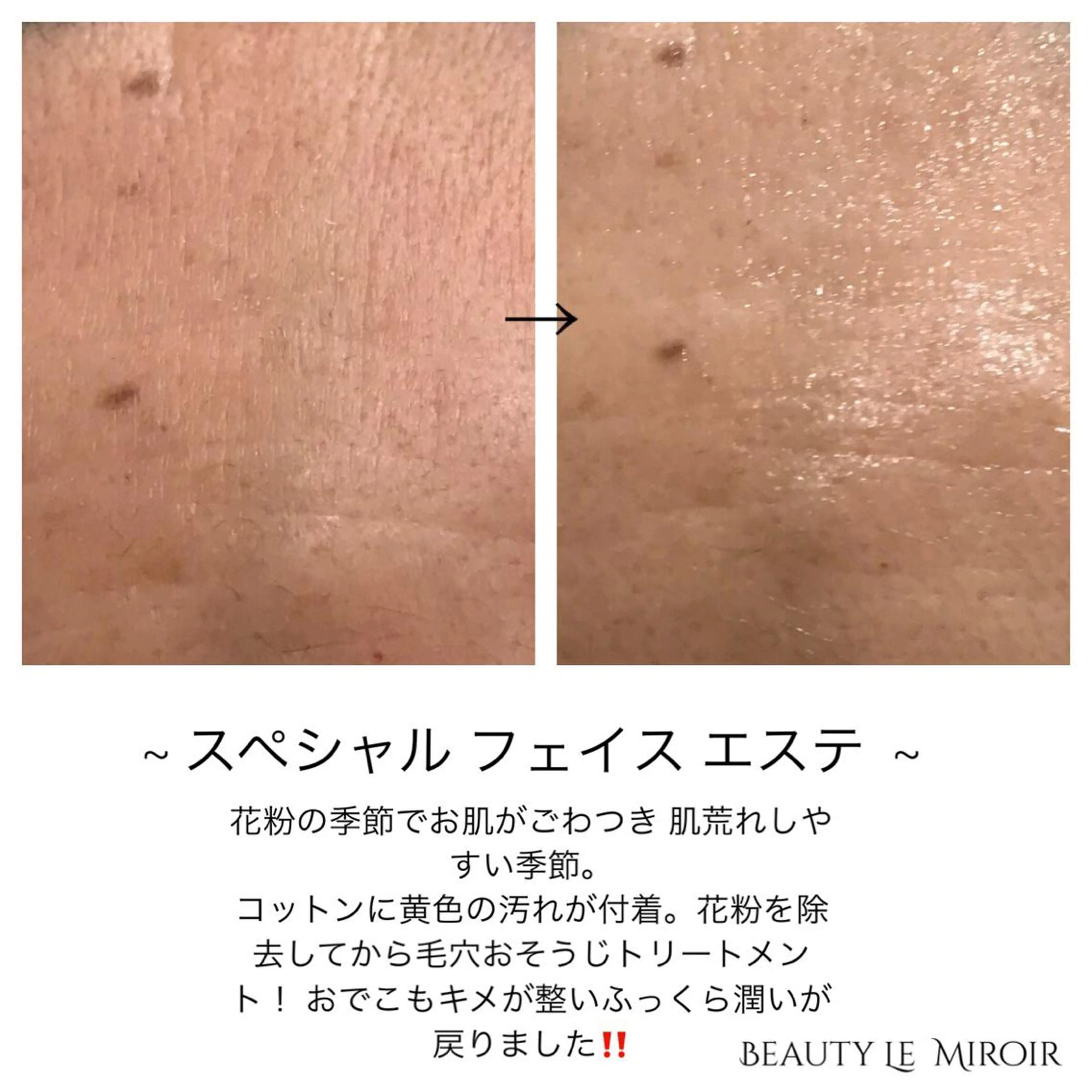 ビューティー ミロワールのエステ・リラクイメージ