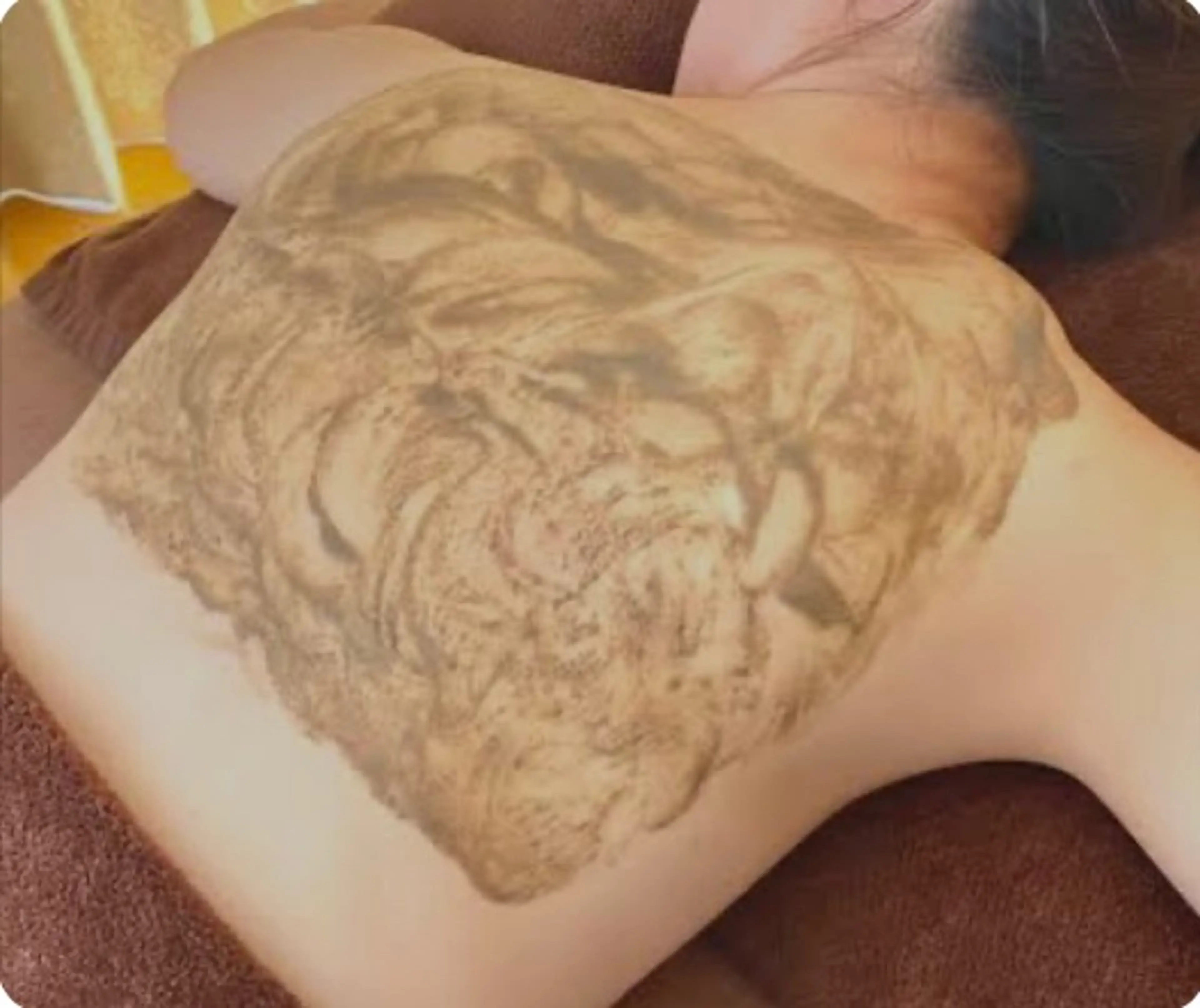 ☆☆ハーブピーリング〈BODY：背中上部〉　（毛穴洗浄同日利用可能）の写真