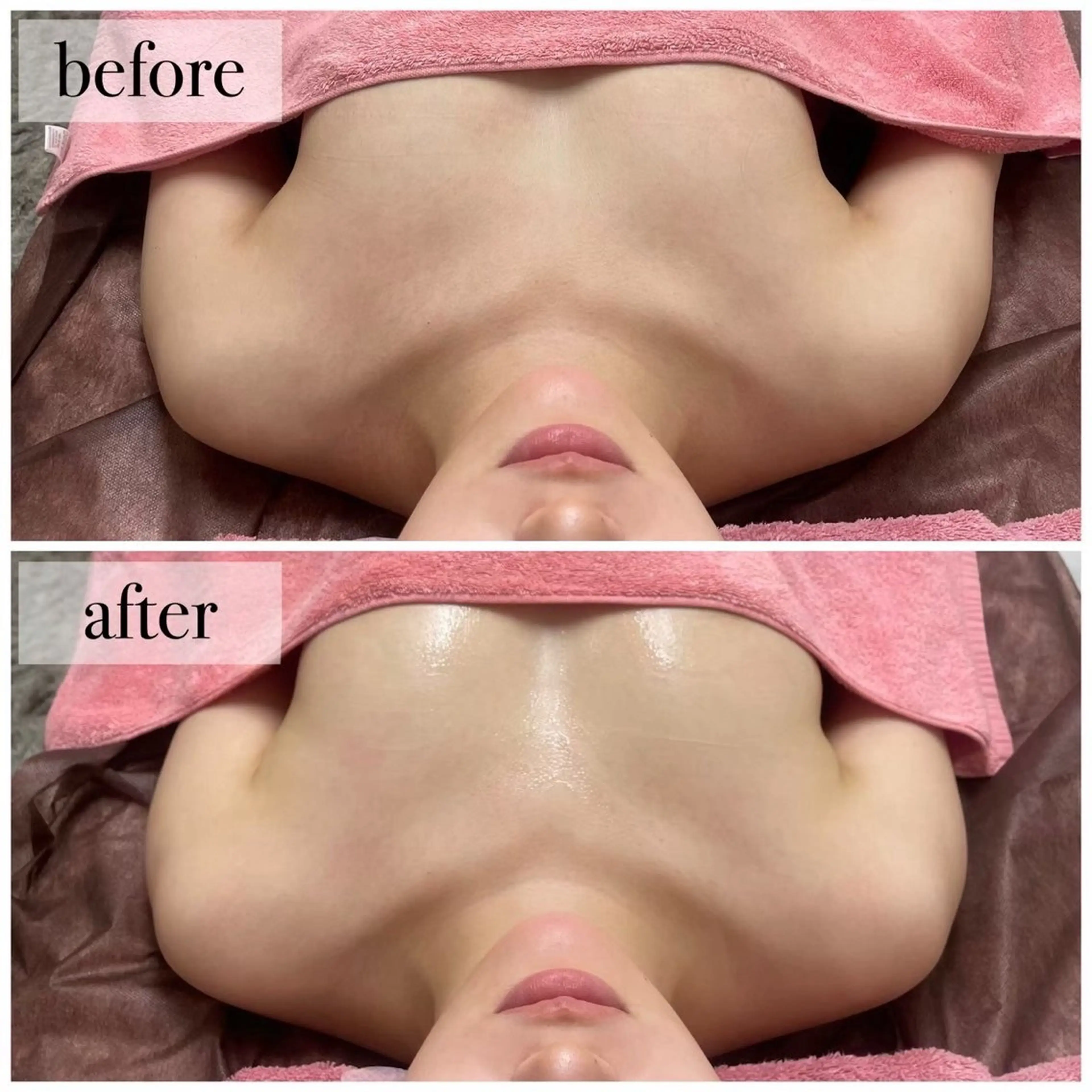 Ellaバストアップ &肌質改善🍃専門店のエステ・リラクイメージ