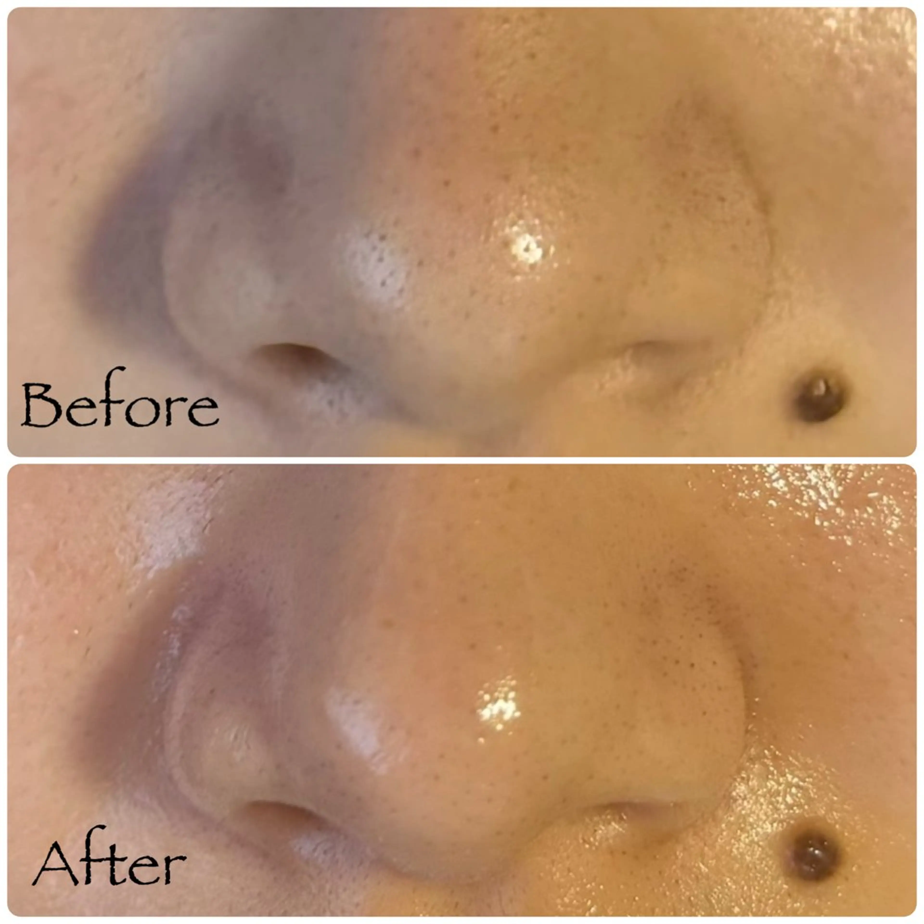 ソワン所属・脱毛 フェイシャル soin~ソワン~のエステ・リラクイメージ