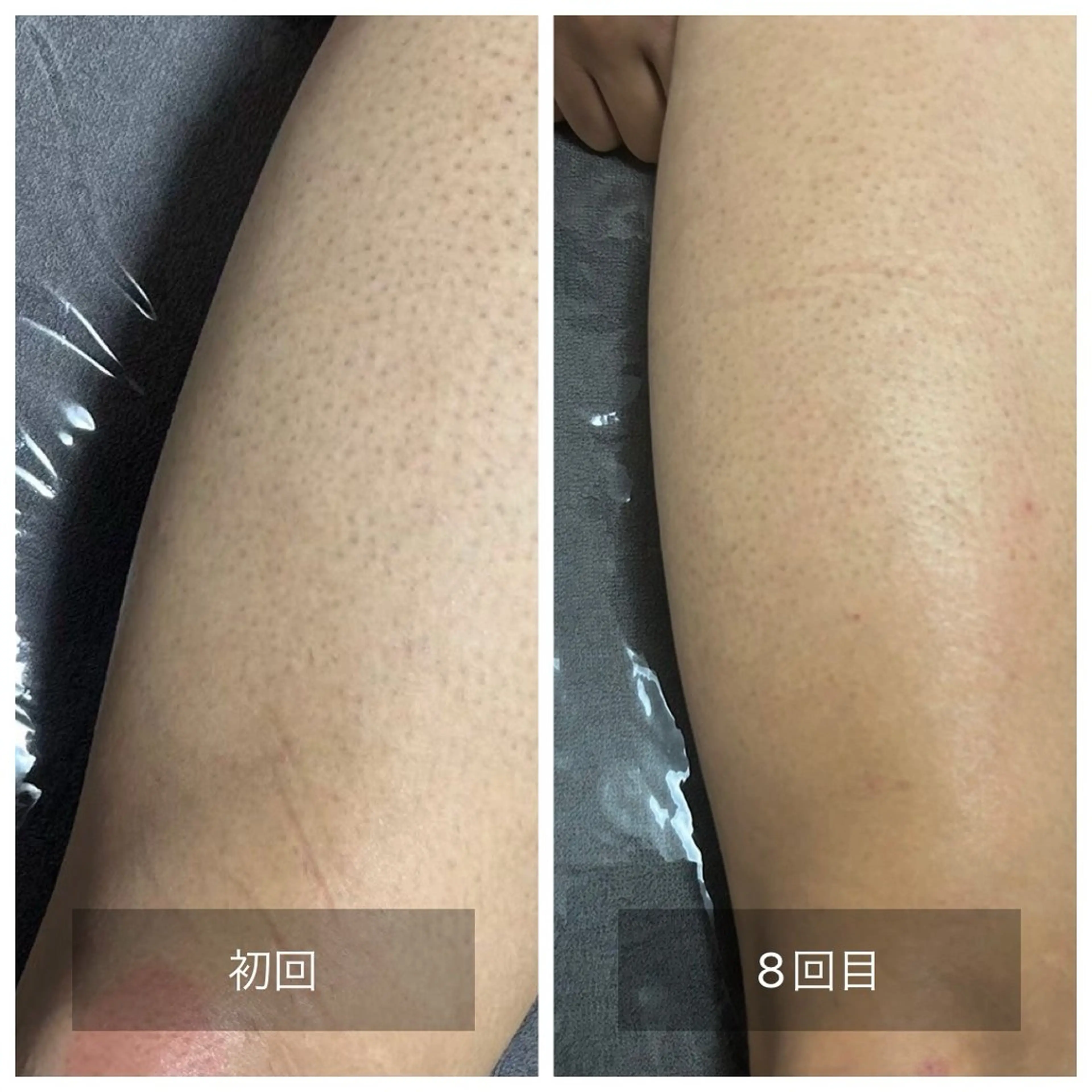 メンズ エマニエル USAのエステ・リラクイメージ