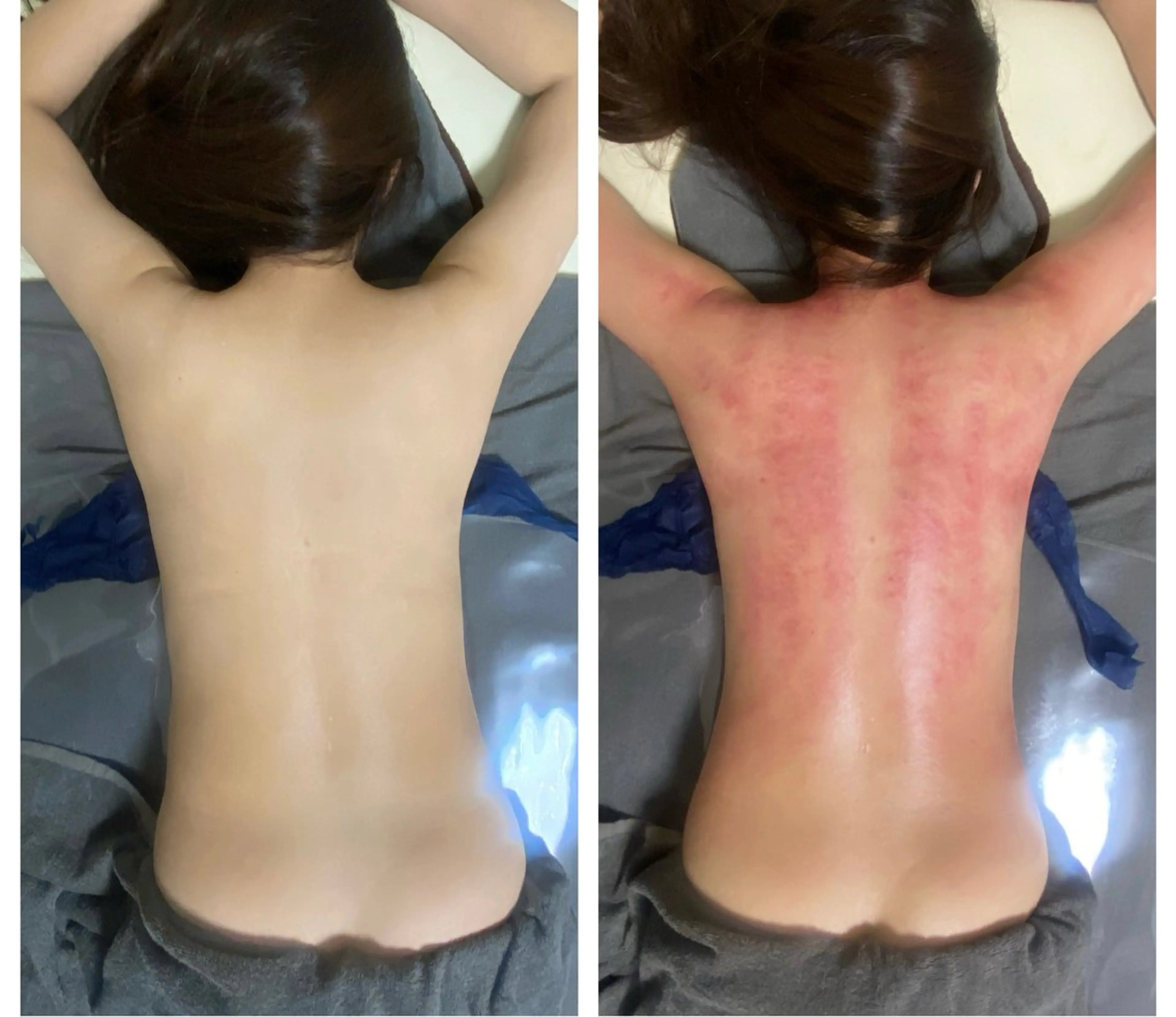 エステ セルライトクラッシュ ＆腸もみ＋骨盤矯正のその他イメージ