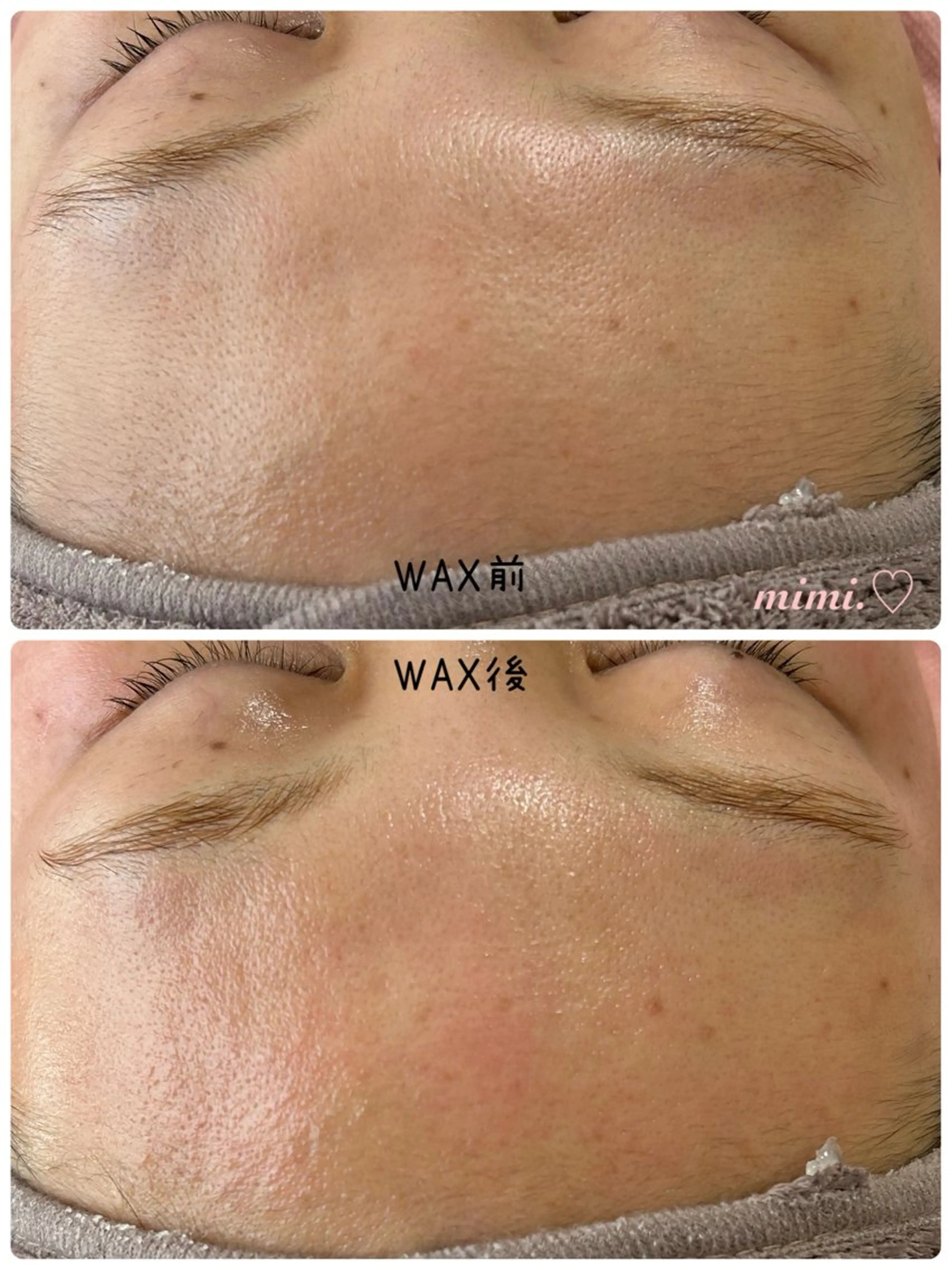 mimi.♡ MINA.のエステ・リラクイメージ