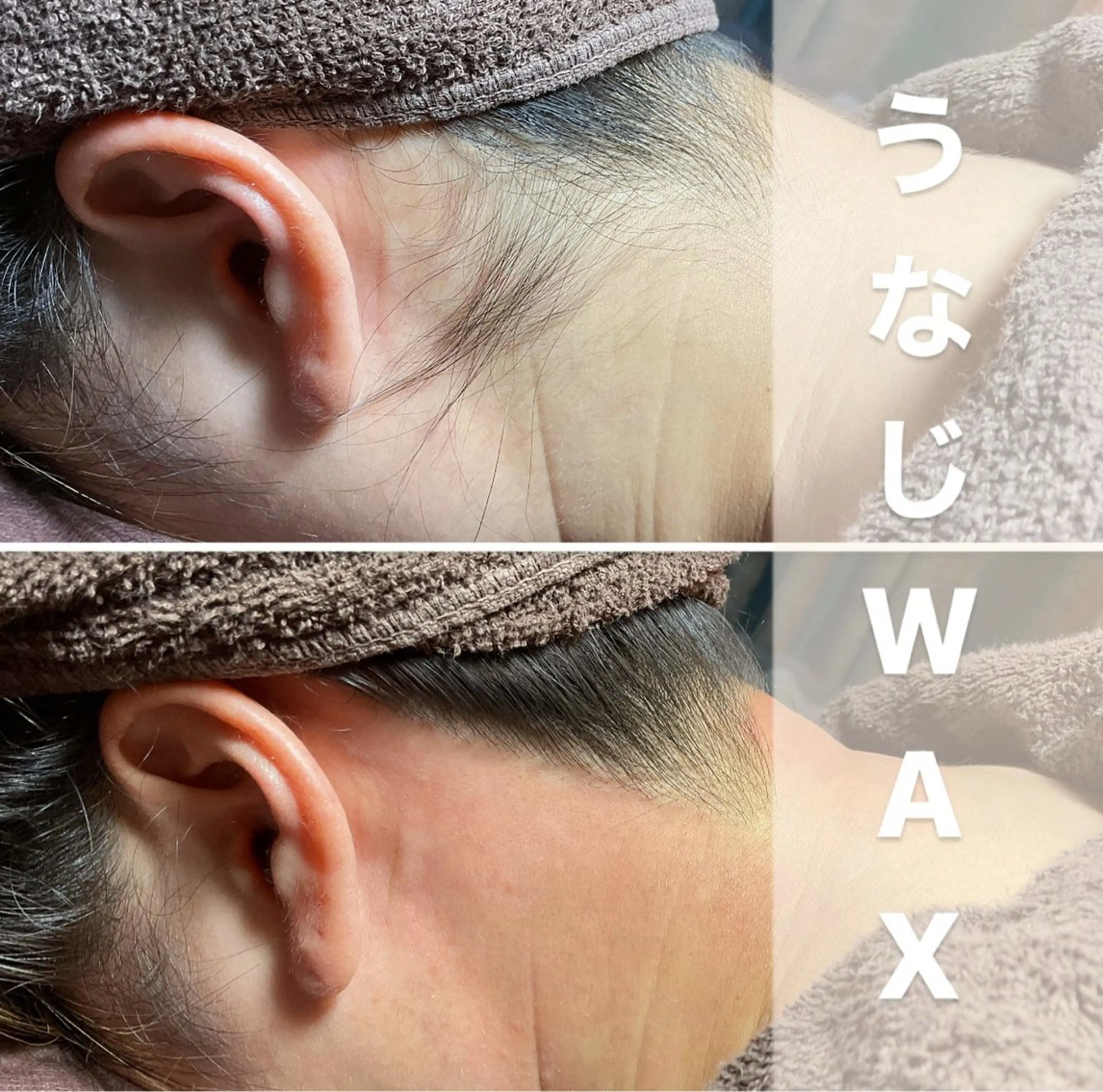 エピナス町田店 ブラジリアンワックスのエステ・リラクイメージ