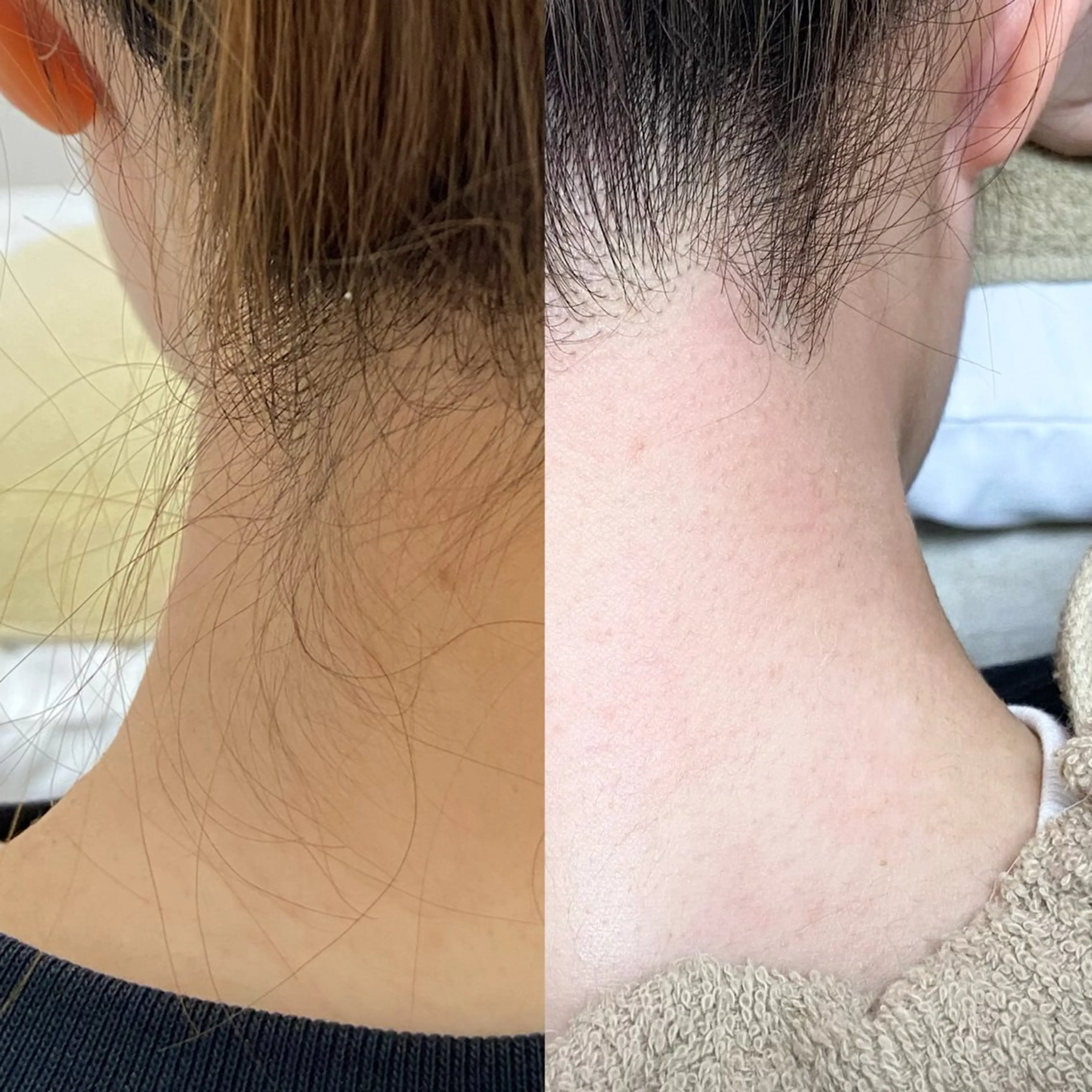 後ろ姿から垢抜け❤️うなじデザインワックスの写真